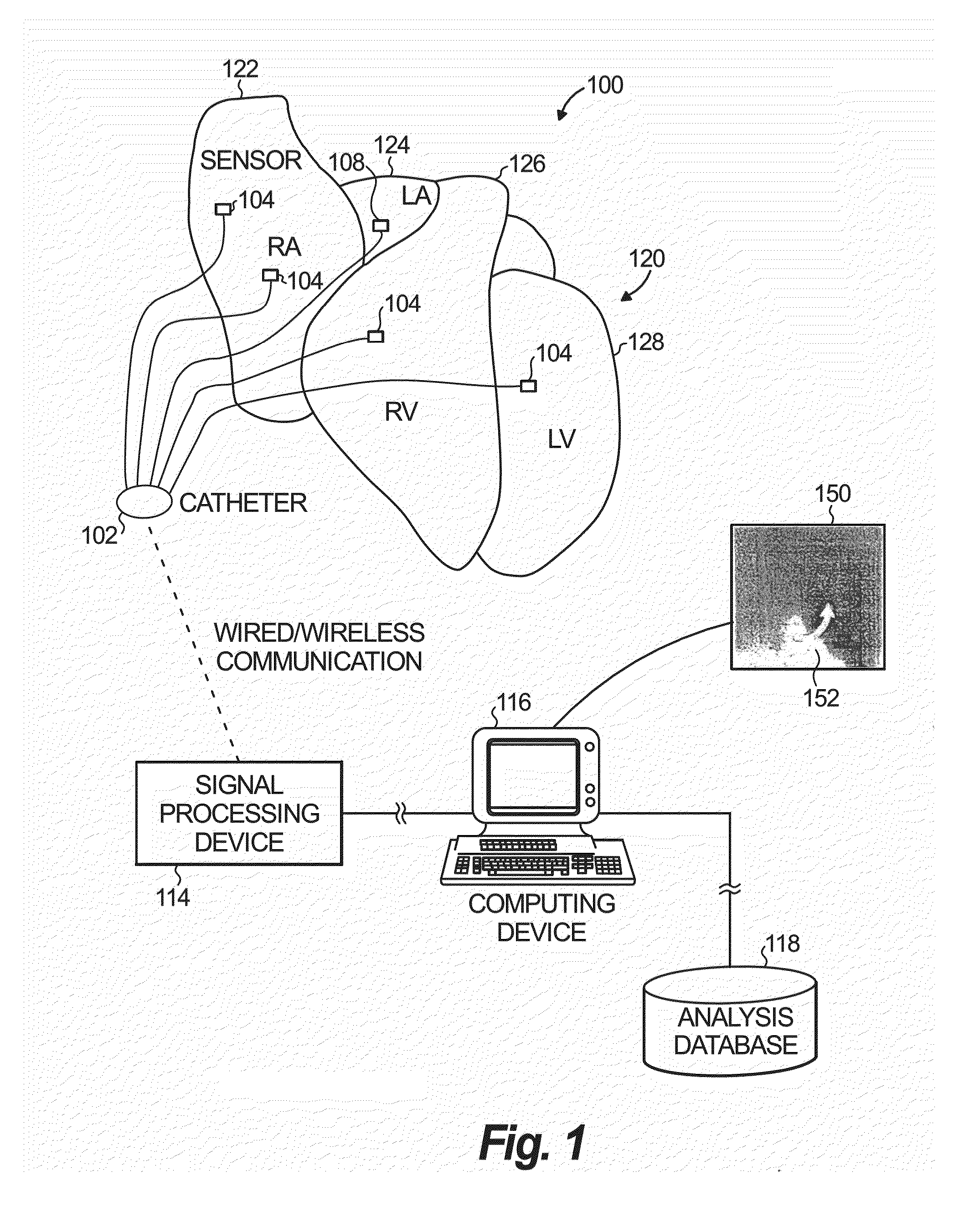 System and method of identifying sources associated with biological rhythm disorders