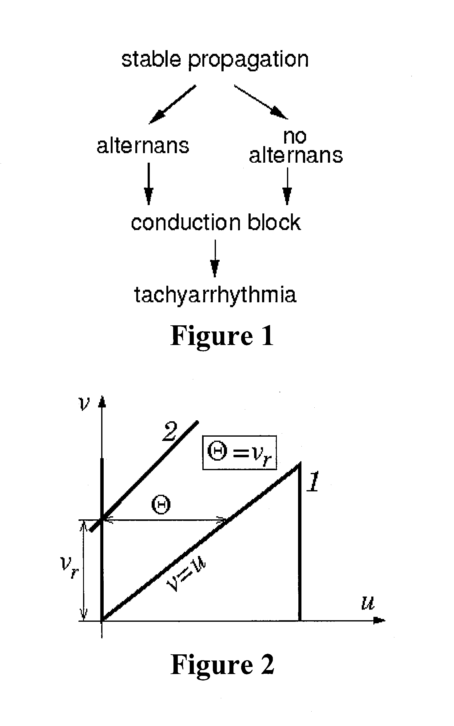 Method and system for evaluating stability of cardiac propagation reserve