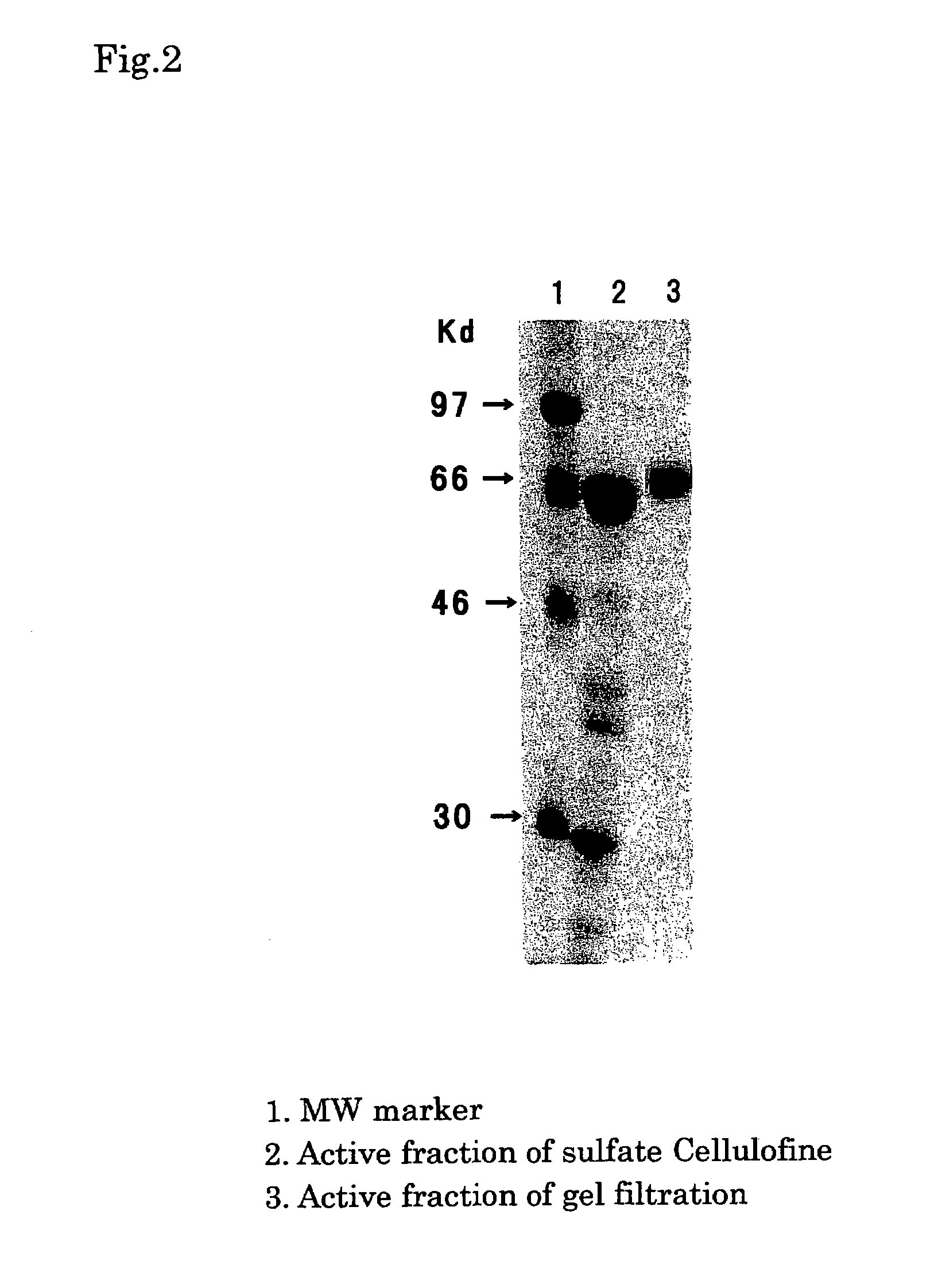 Process for producing human thrombin by gene modification technique