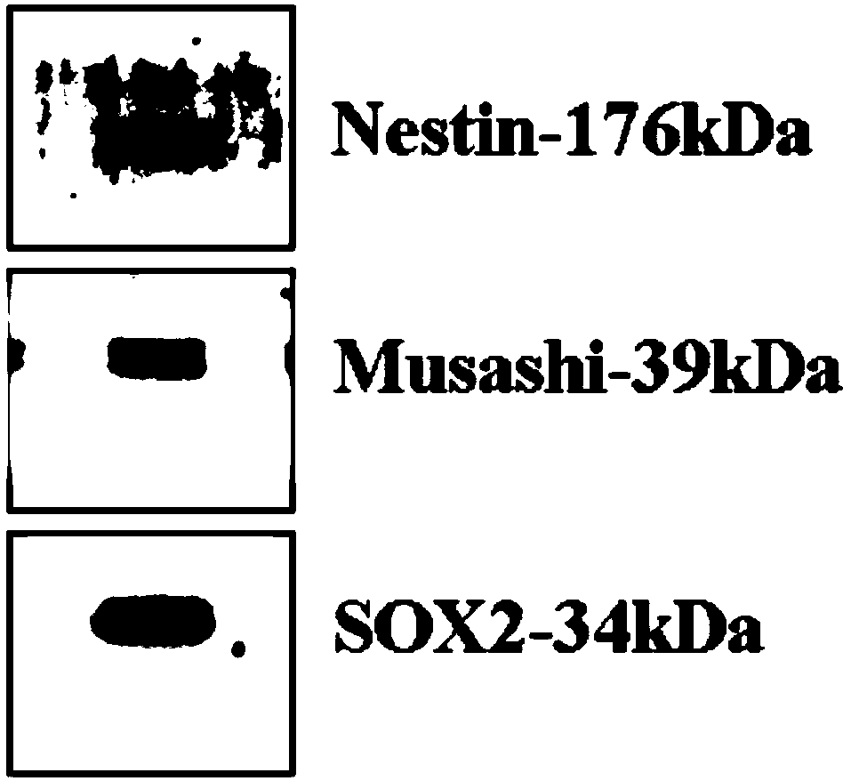 Immortalized human neural stem cell line and preparation method thereof