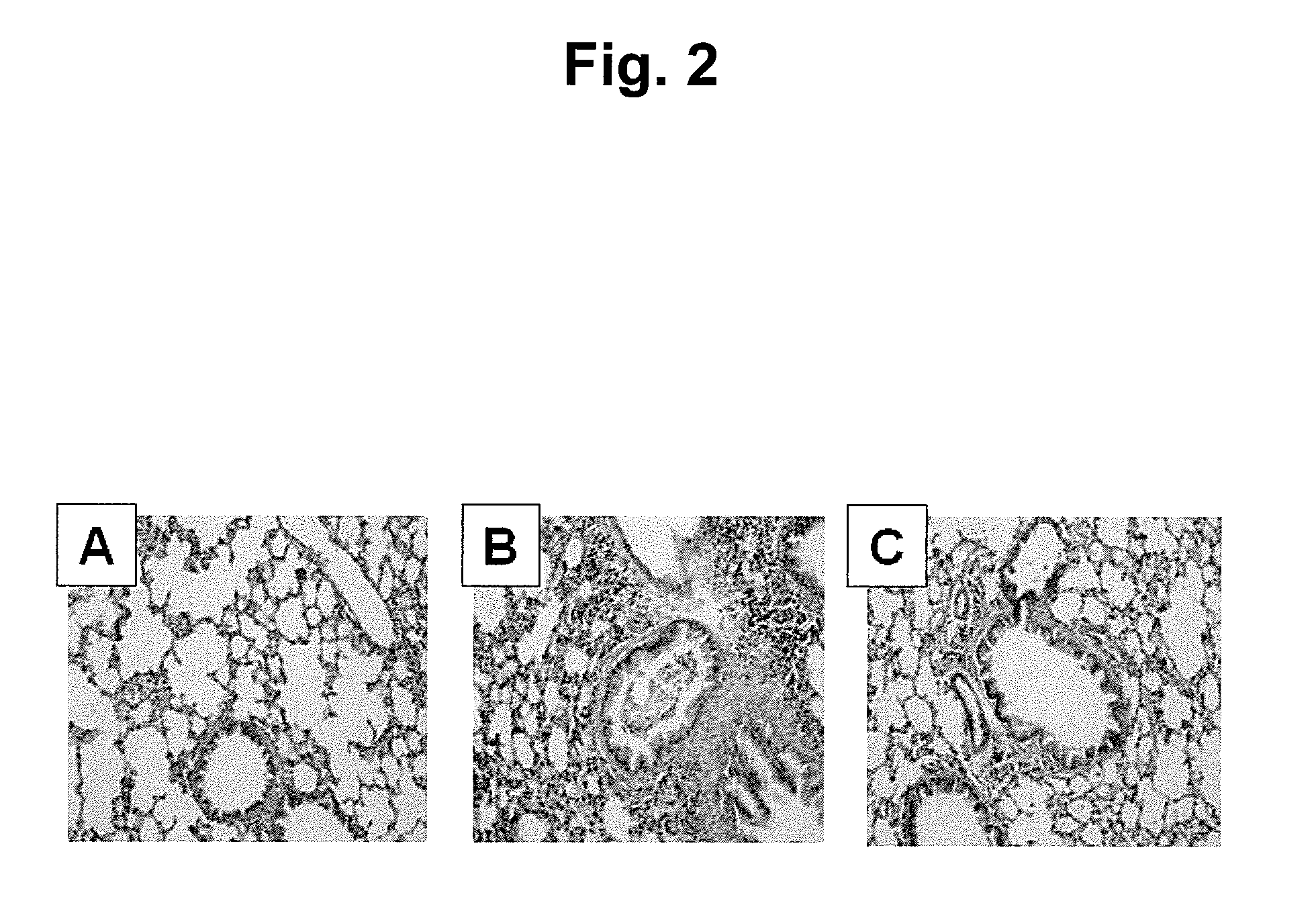 Ecklonia cava extracts for alleviating or preventing asthmatic reactions