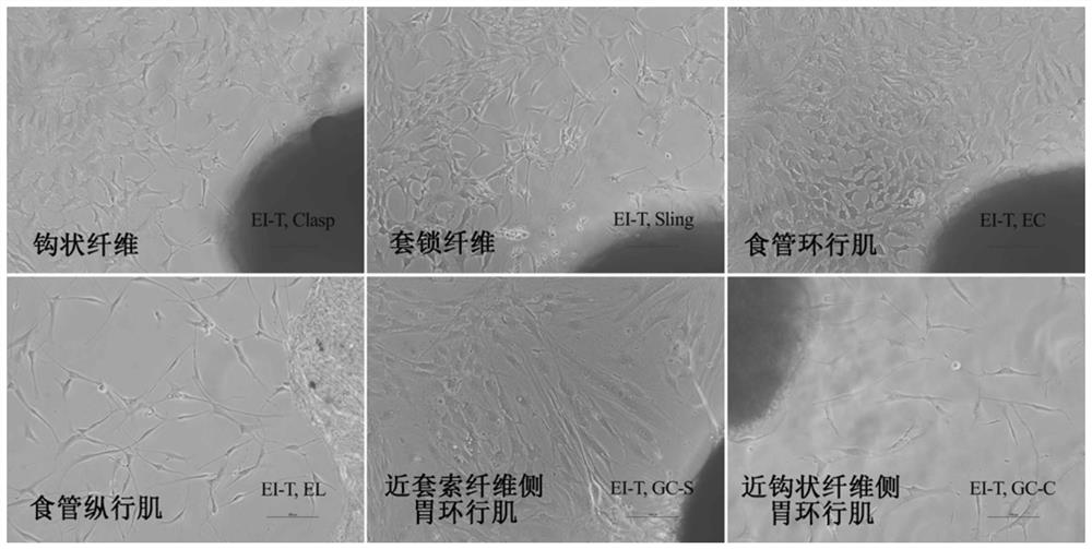 A method for primary culture and identification of esophagogastric junction smooth muscle cells by tissue block method