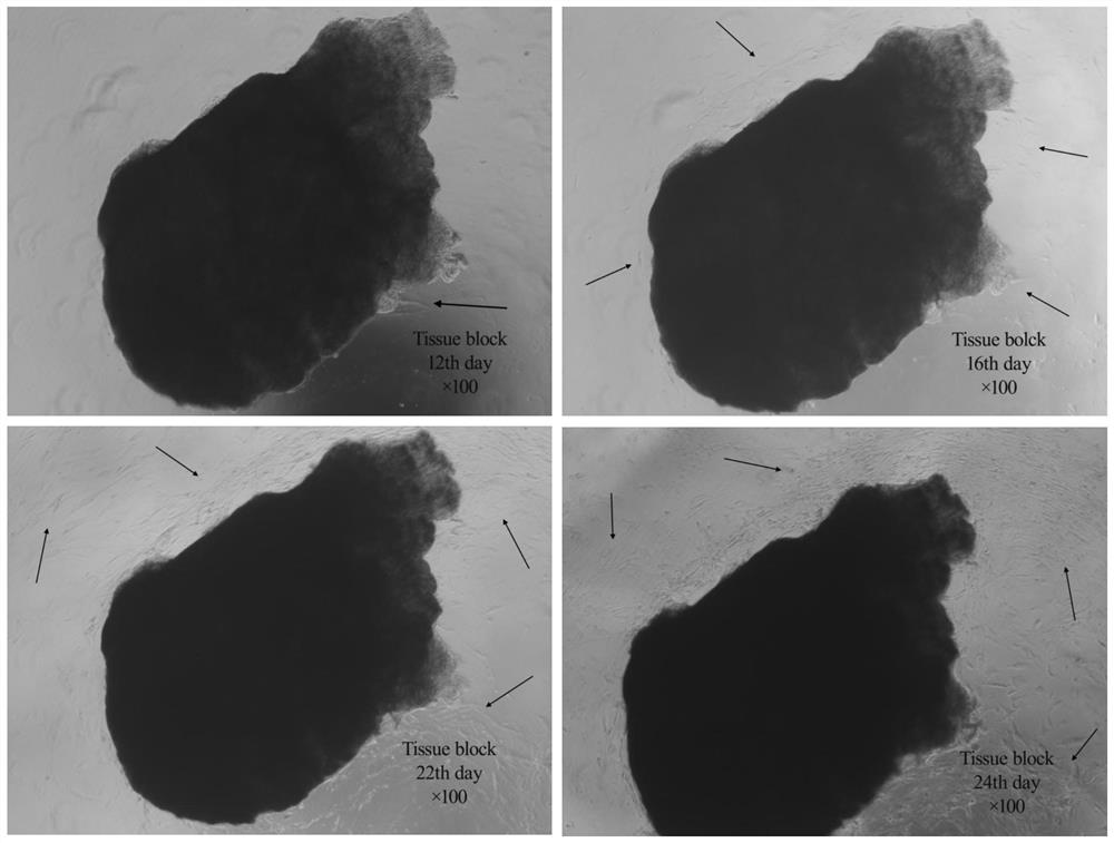 A method for primary culture and identification of esophagogastric junction smooth muscle cells by tissue block method