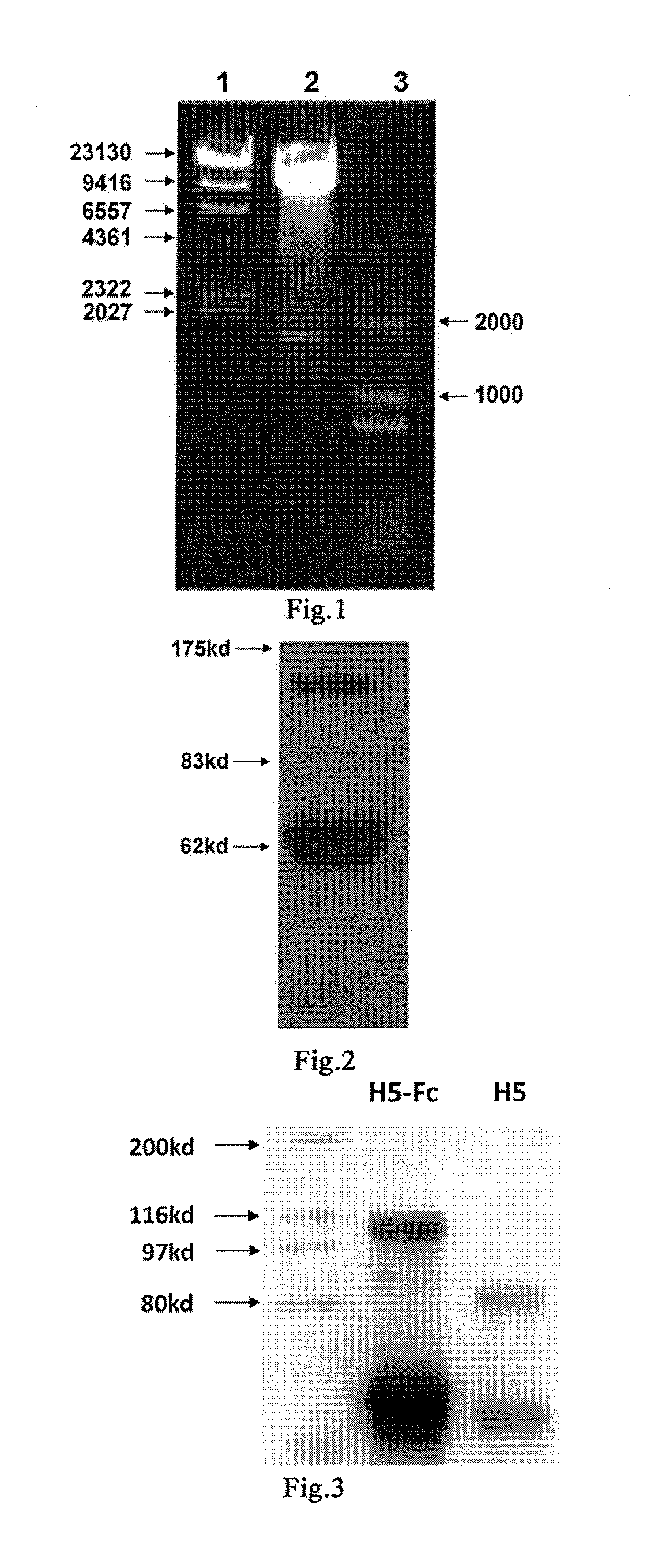 Use of cell autophagy (type ii cell apoptosis) inhibitors