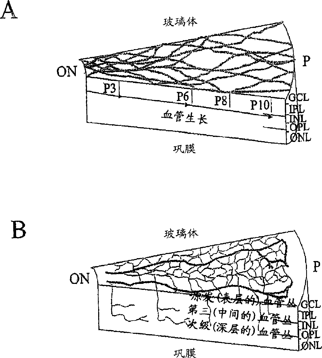 Hematopoietic stem cells and methods of treatment of neovascular eye diseases therewith