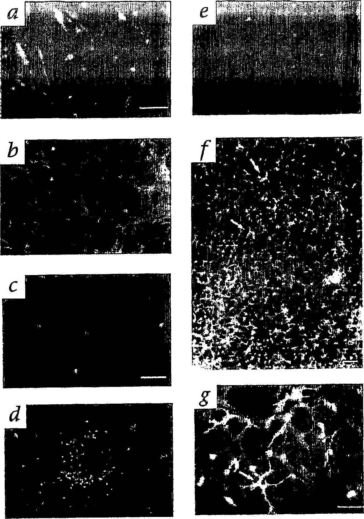 Hematopoietic stem cells and methods of treatment of neovascular eye diseases therewith