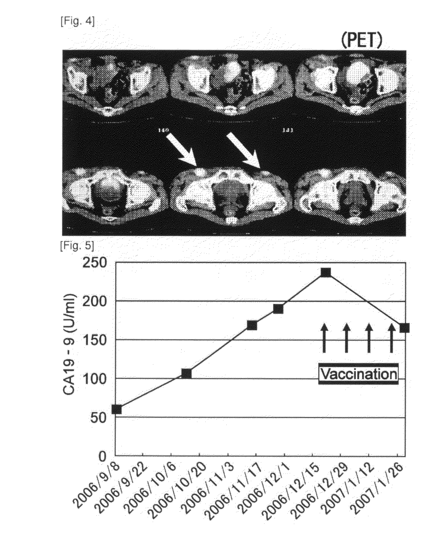 Combination therapy for pancreatic cancer using an antigenic peptide and chemotherapeutic agent