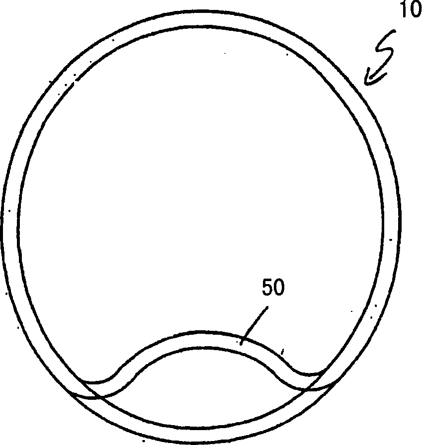 Skin treatment articles and methods