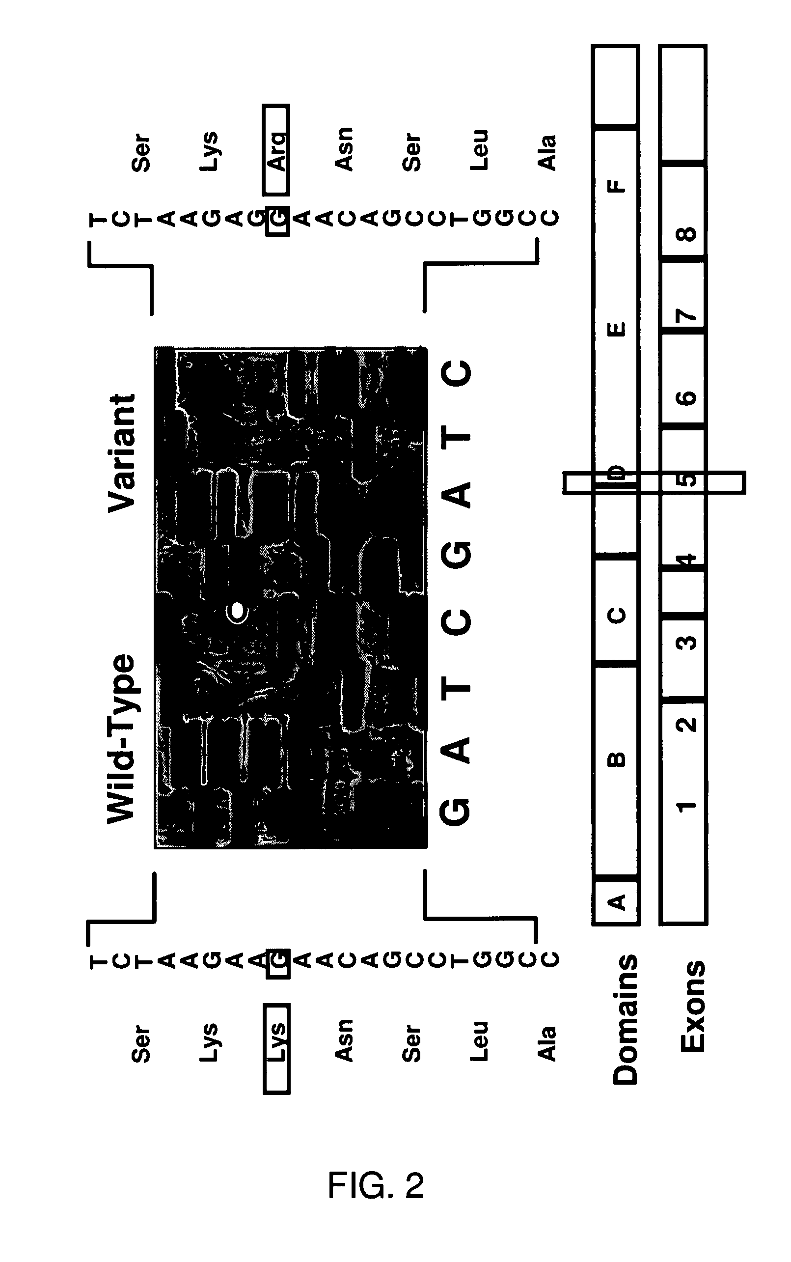 Methods and compositions in breast cancer diagnosis and therapeutics