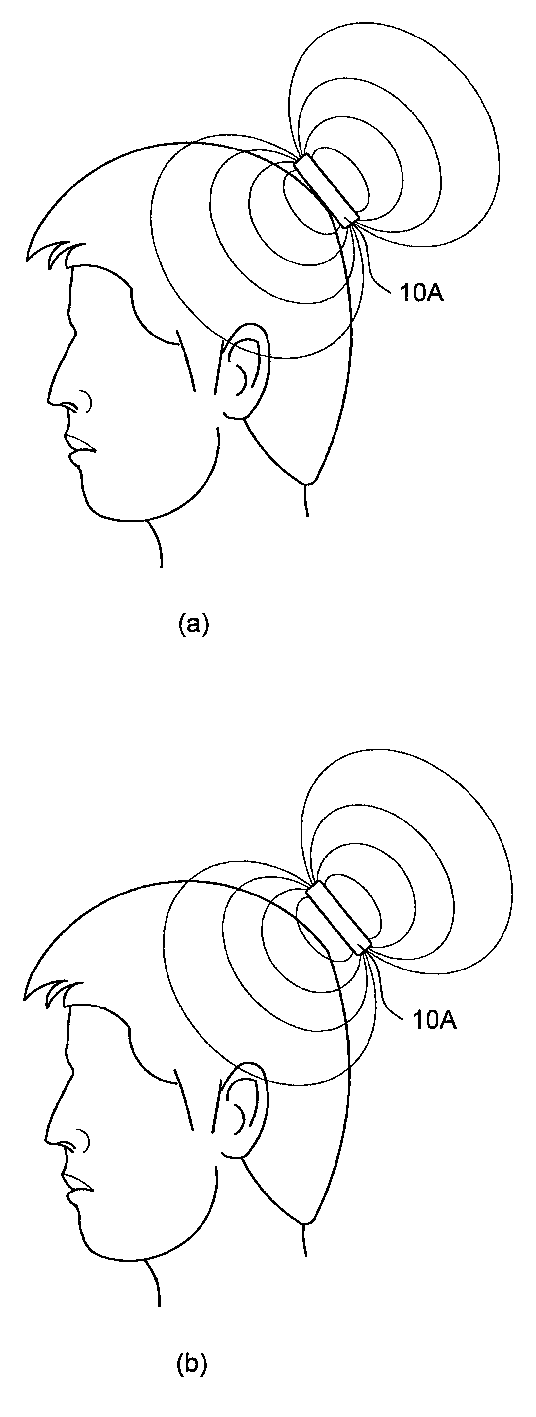 Neurotrophic factor production promoting device