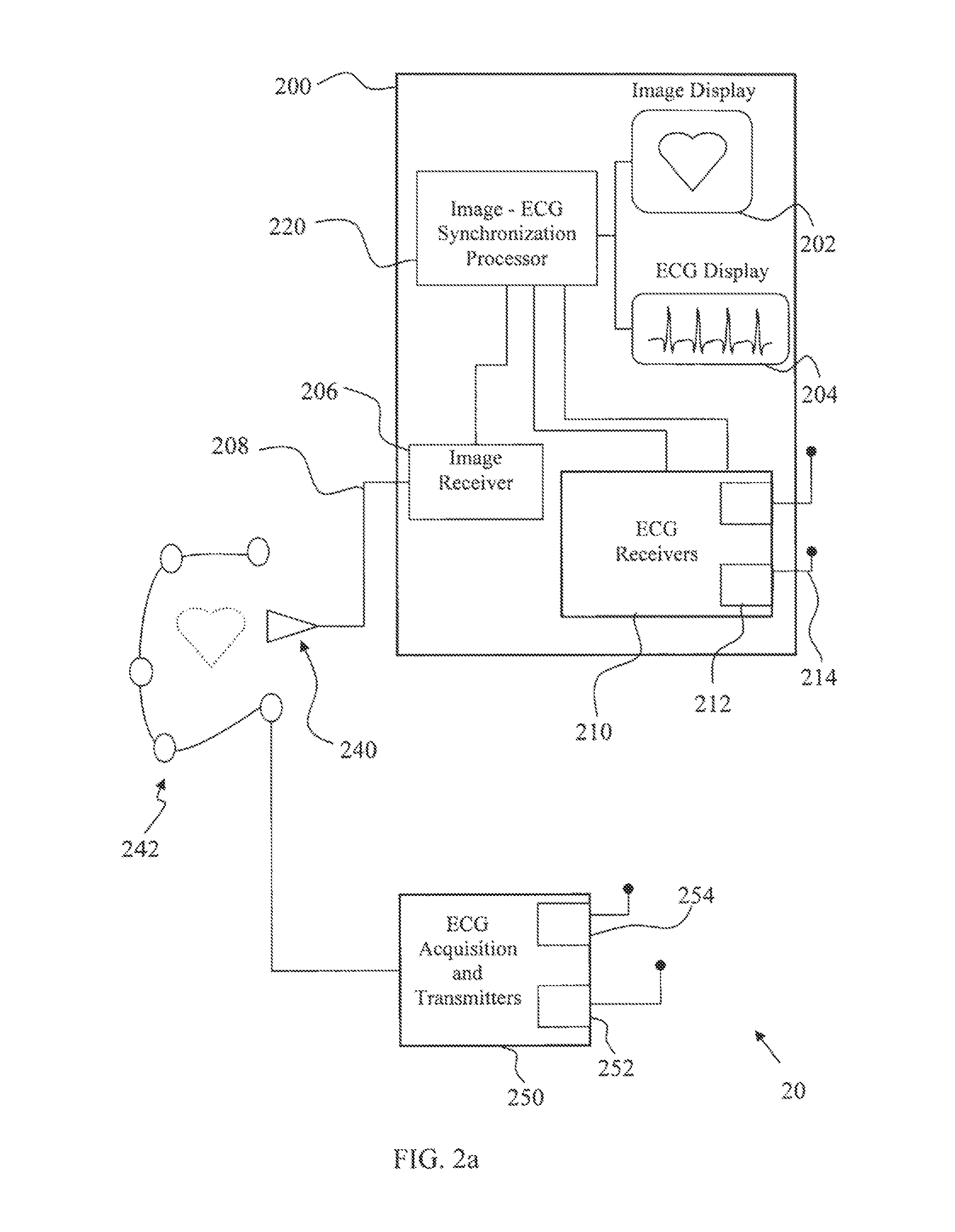 Wireless real-time electrocardiogram and medical image integration