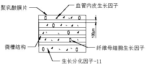 Stent for directional induction of neural stem cell differentiation and preparation method thereof