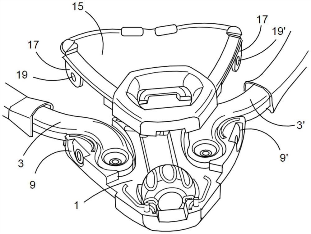 Adjustment member for mandibular advancement device