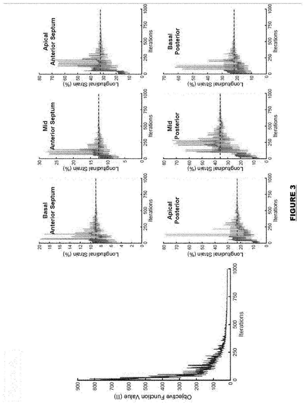 Non-invasive estimation of the mechanical properties of the heart