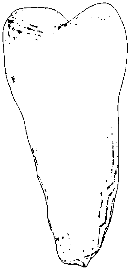 NiTi memory alloy gradient porous personalized dental implant and manufacturing method thereof