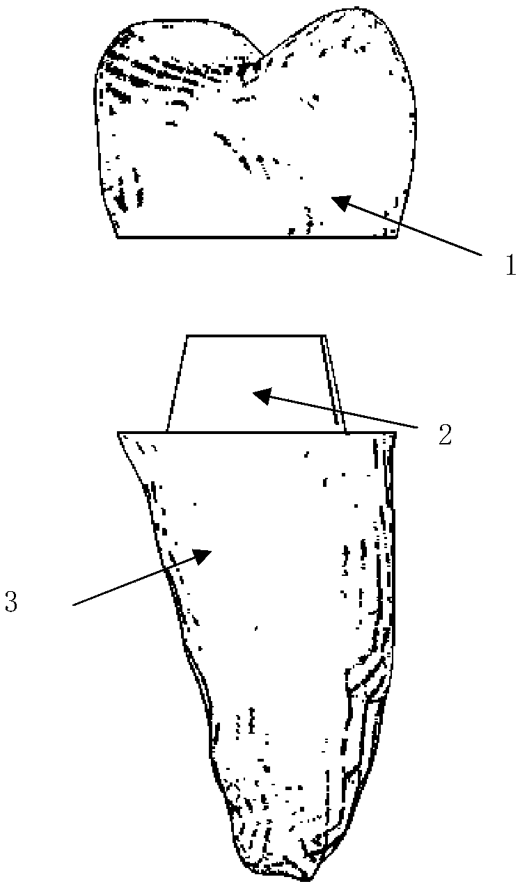 NiTi memory alloy gradient porous personalized dental implant and manufacturing method thereof