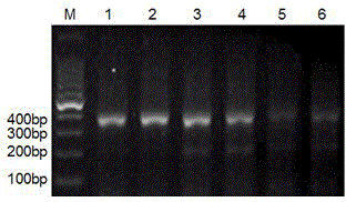 Leukemia single-chain antibody library, as well as construction method and application thereof