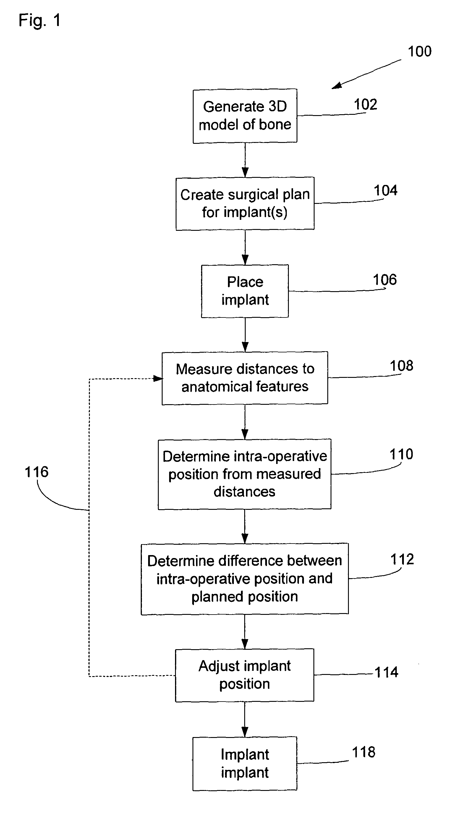 Intra-operative surgical plan changing