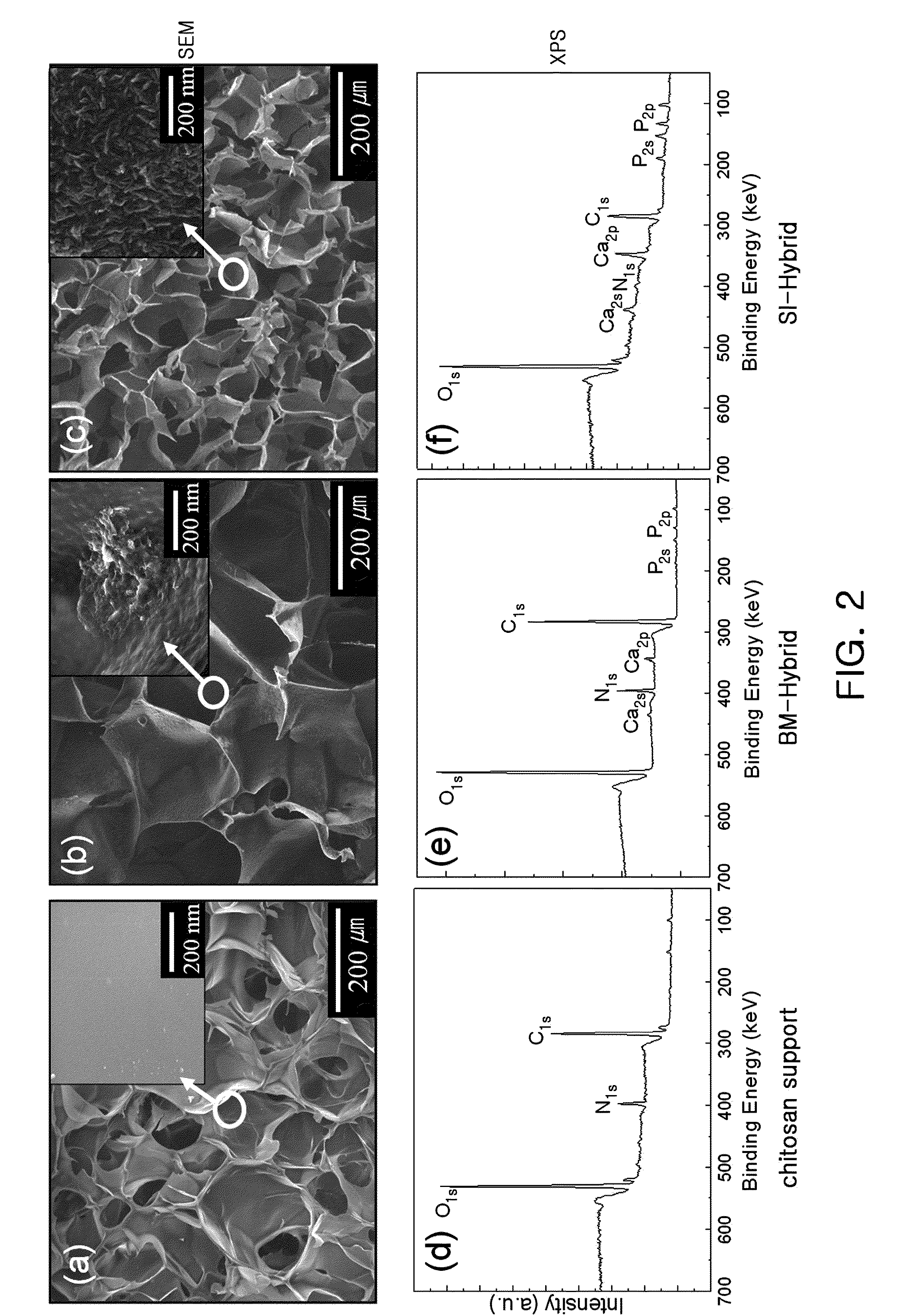 Organic-inorganic hybrid scaffolds with surface-immobilized nano-hydroxyapatite and preparation method thereof