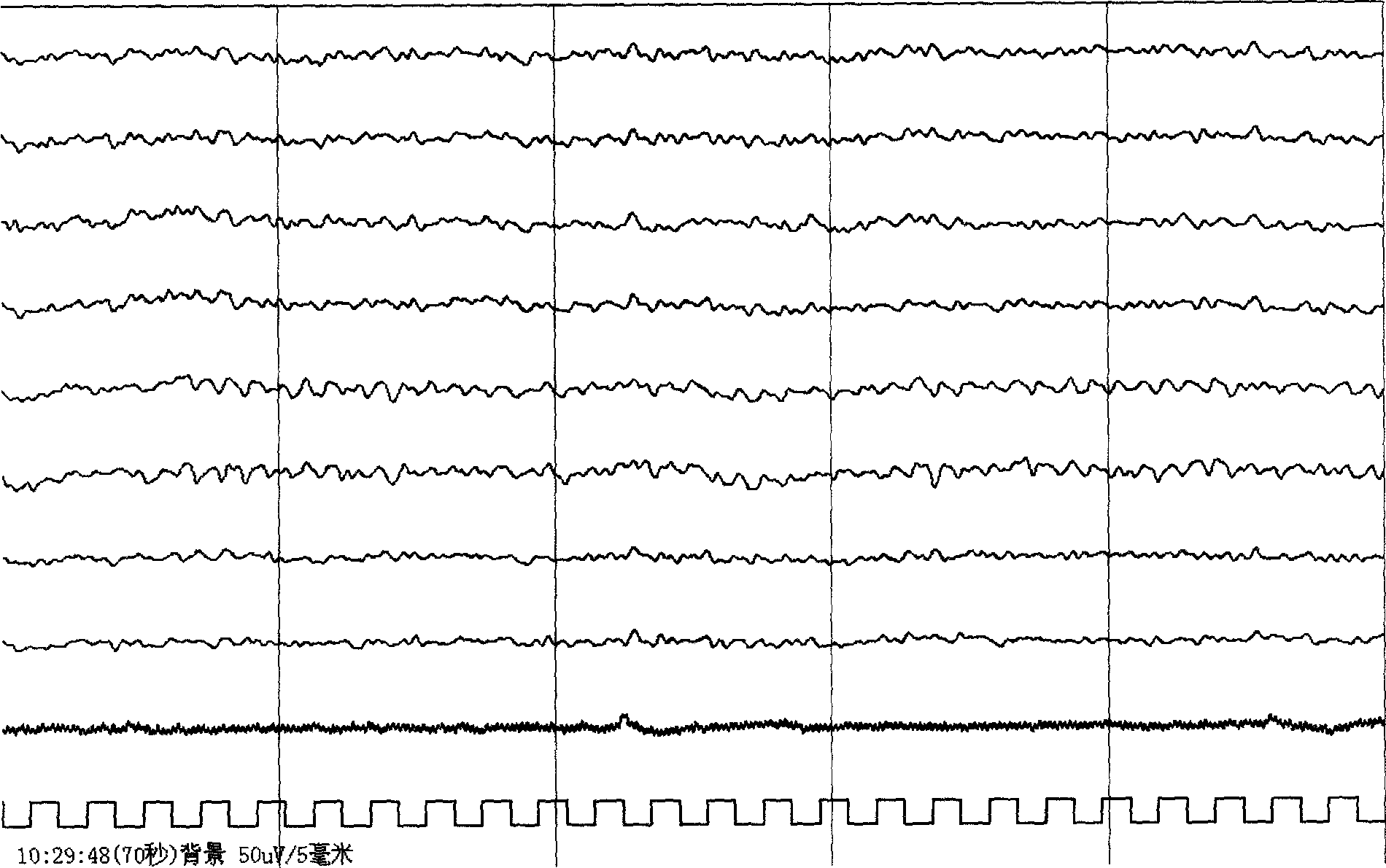 Method for generating electrocortical potential nonlinear trend diagram used in real-time monitoring