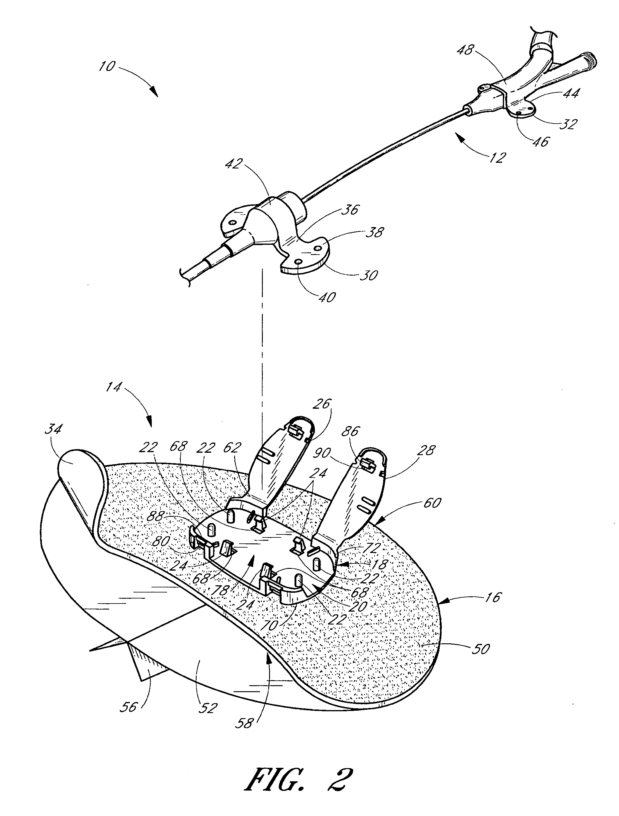 Medical article anchoring system