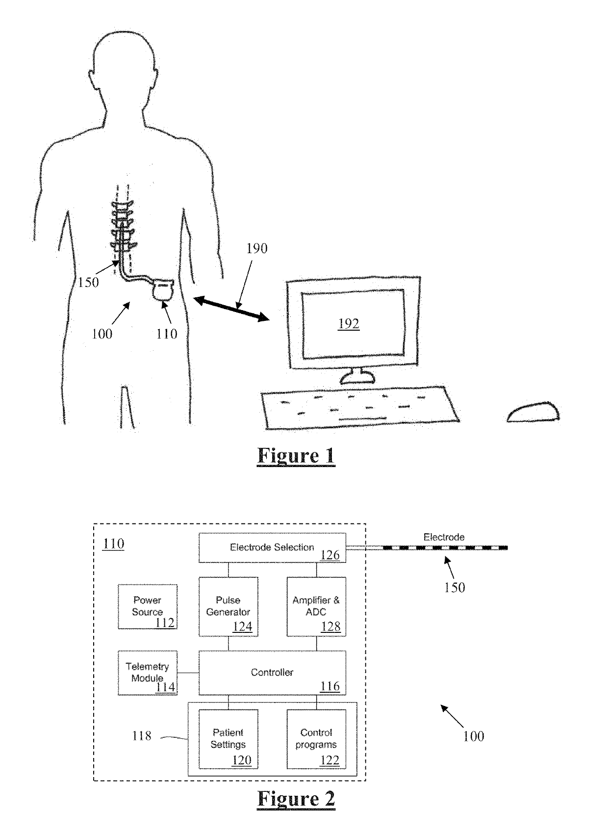 Neural Stimulation for Reduced Artefact