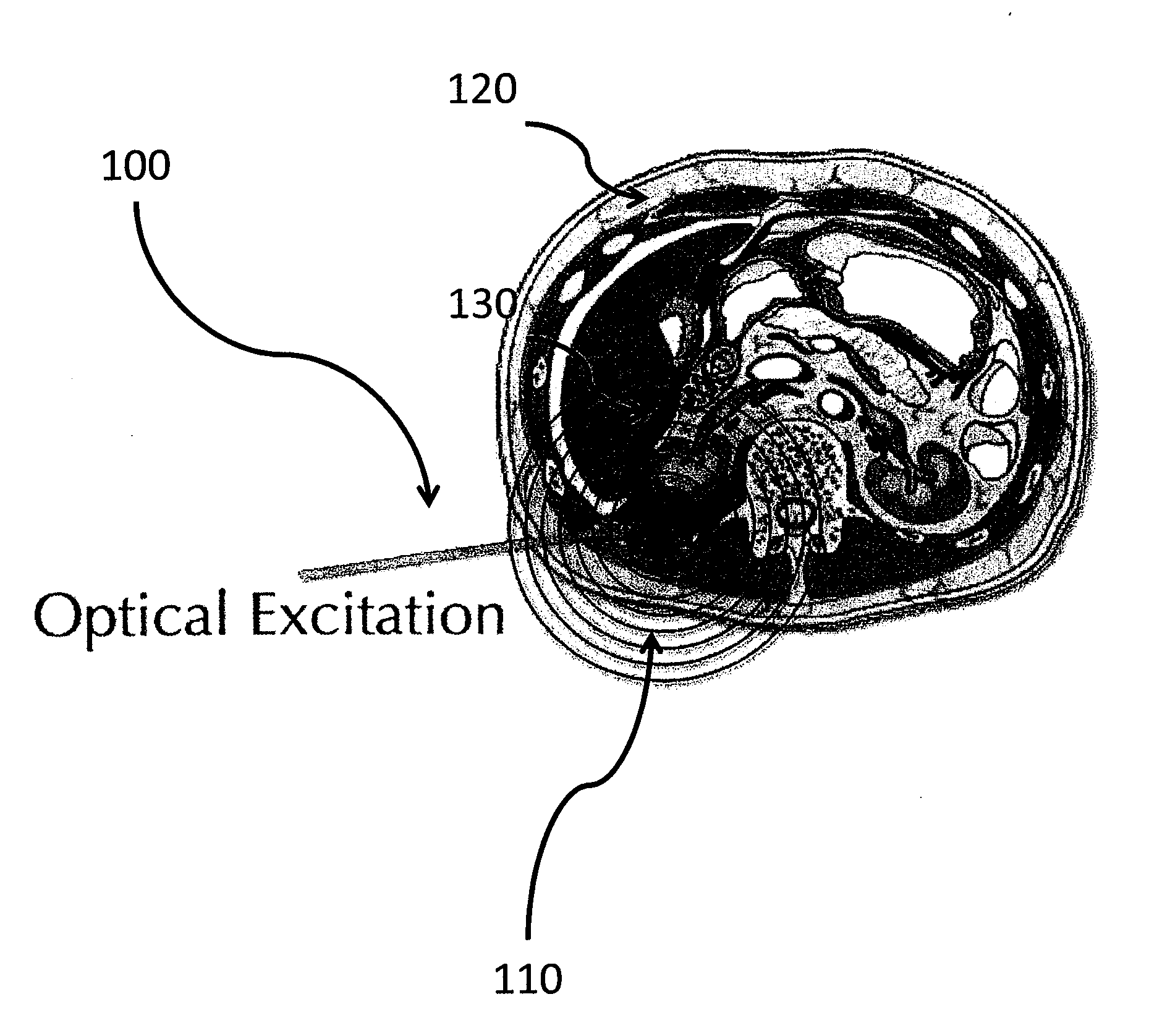 Apparatus and method for providing a noninvasive diagnosis of internal bleeding