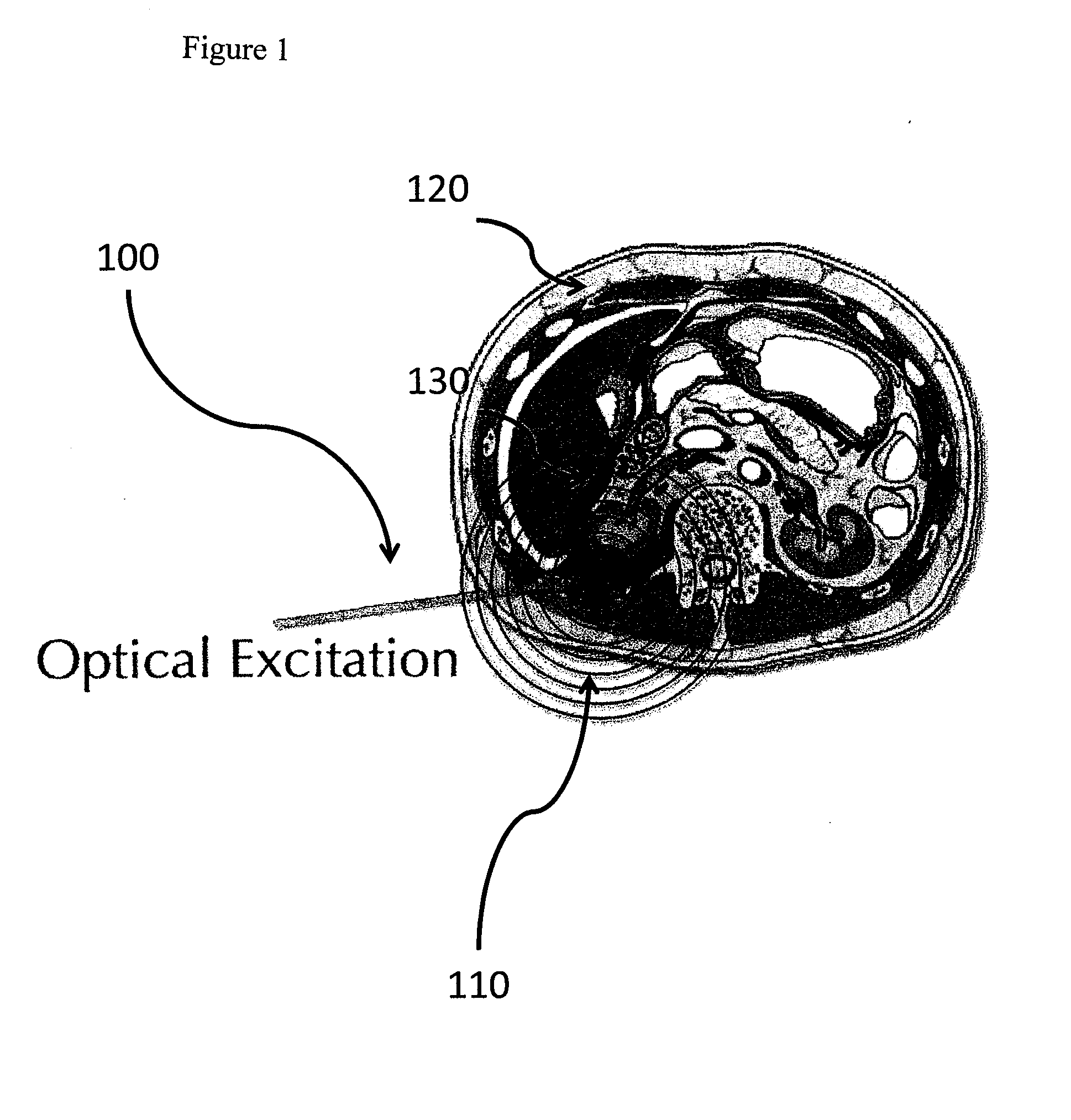 Apparatus and method for providing a noninvasive diagnosis of internal bleeding