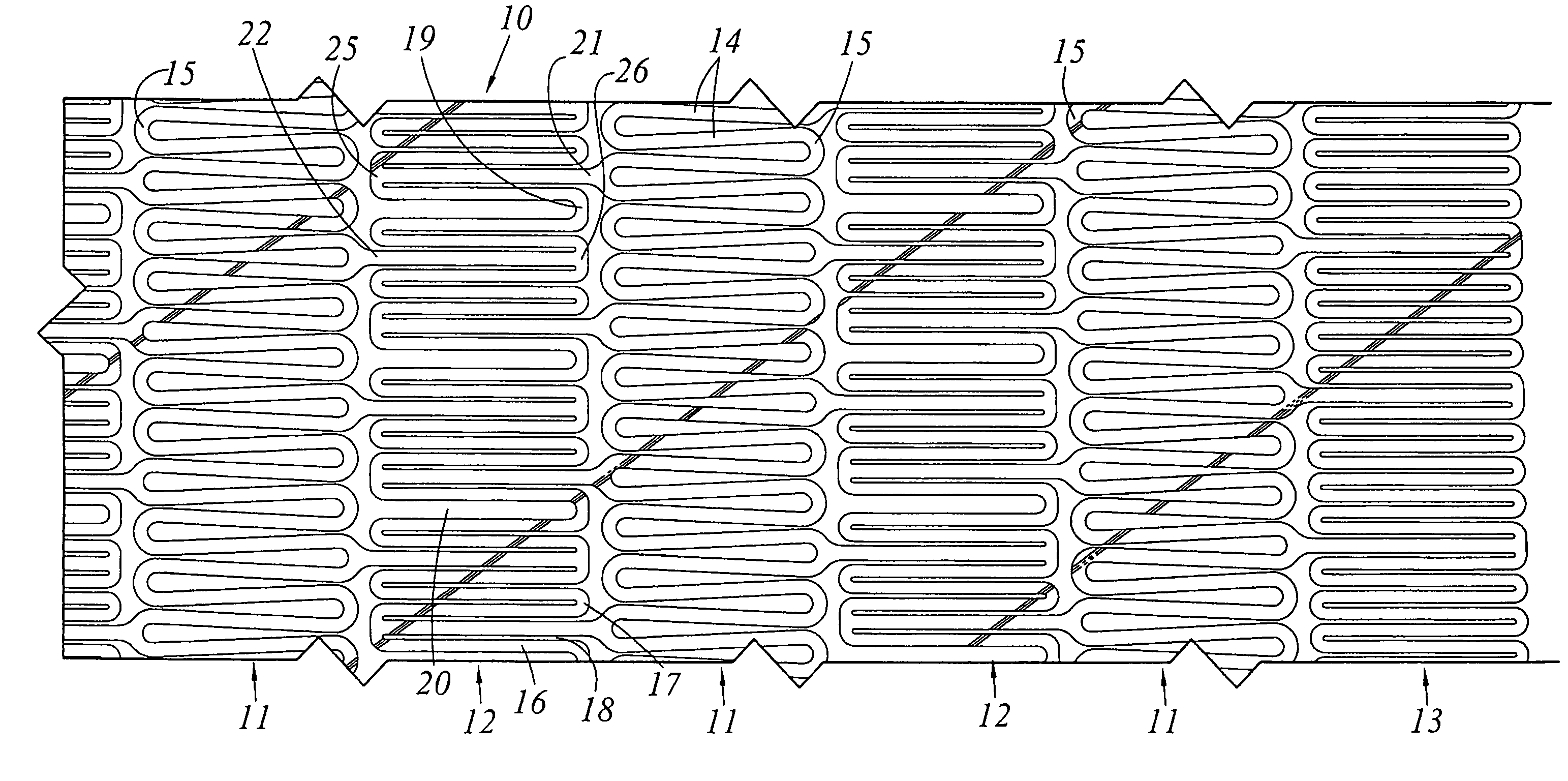 Cannula stent