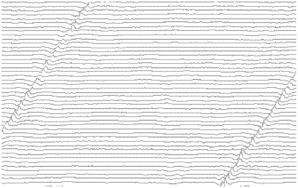 A method for judging the signal of the inner detection line of the three-axis magnetic flux leakage in a pipeline depression