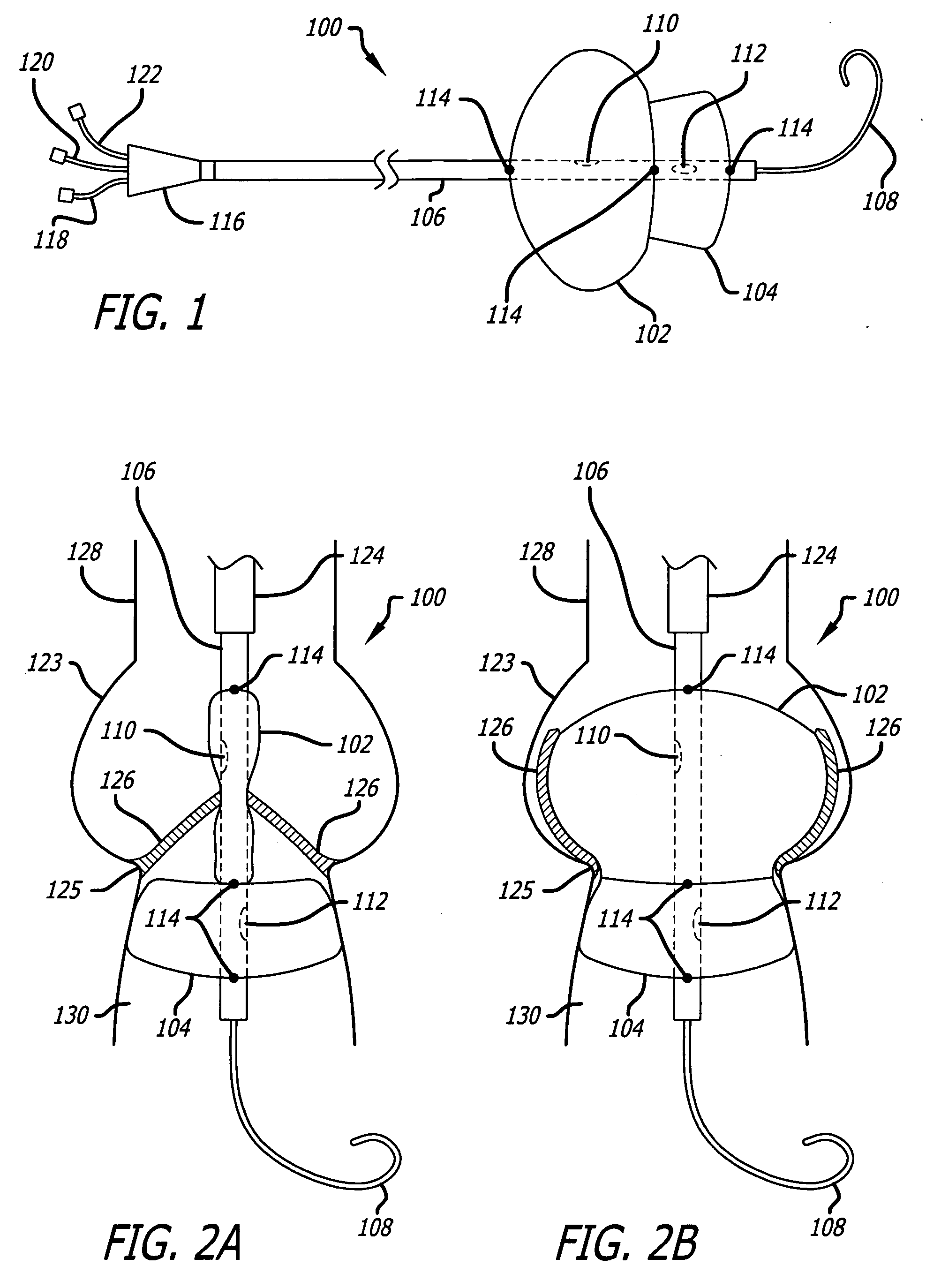 Valvuloplasty catheter