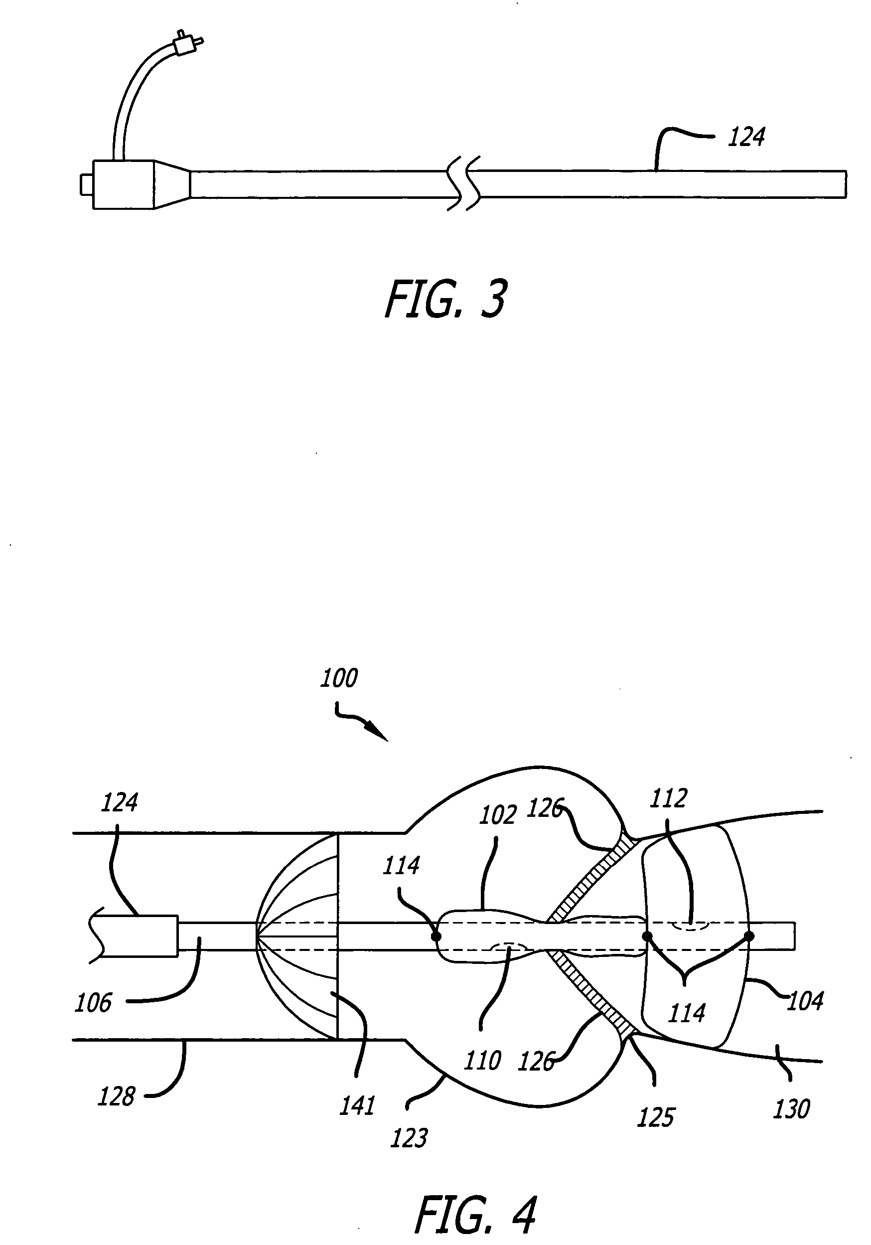 Valvuloplasty catheter