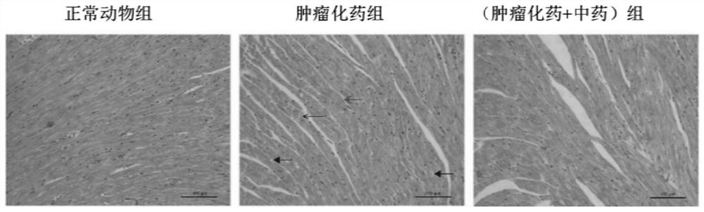 Application of a traditional Chinese medicine composition in the preparation of medicines for alleviating cardiotoxicity caused by anticancer drugs