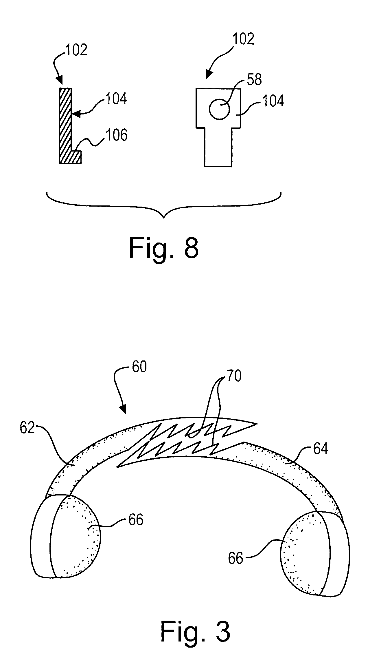 Method and apparatus for treating periprosthetic fractures of the distal femur