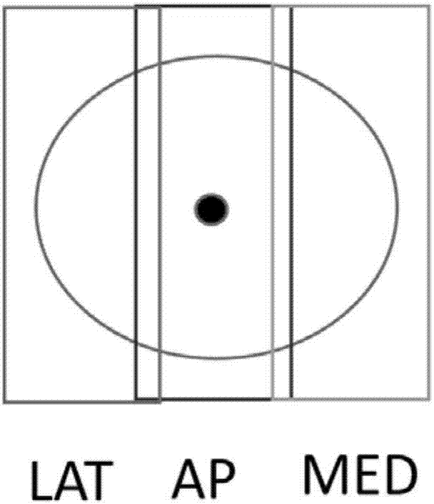 Computer breast scanning automatic machine positioning system