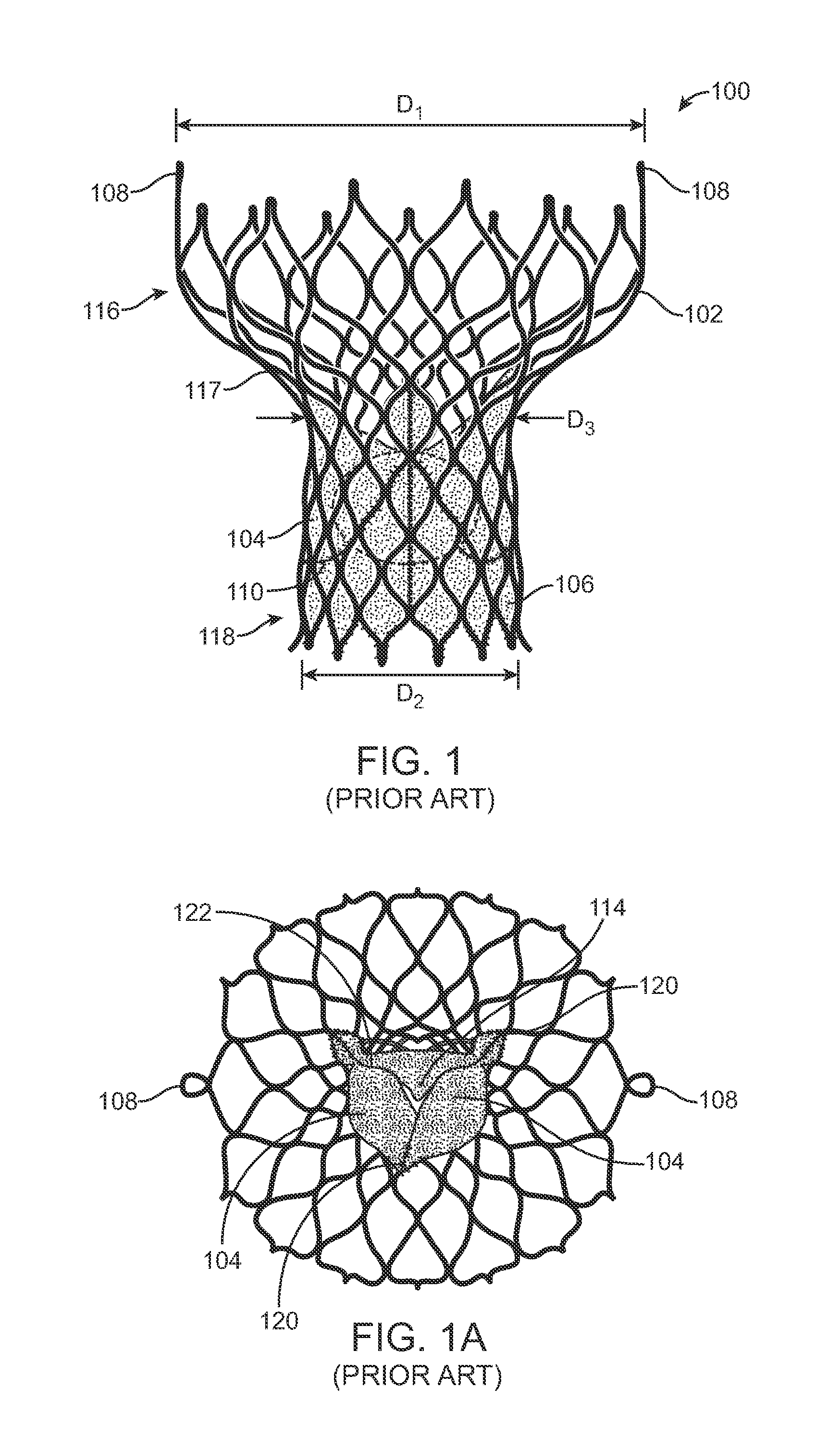 Anti-Paravalvular Leakage Component for a Transcatheter Valve Prosthesis