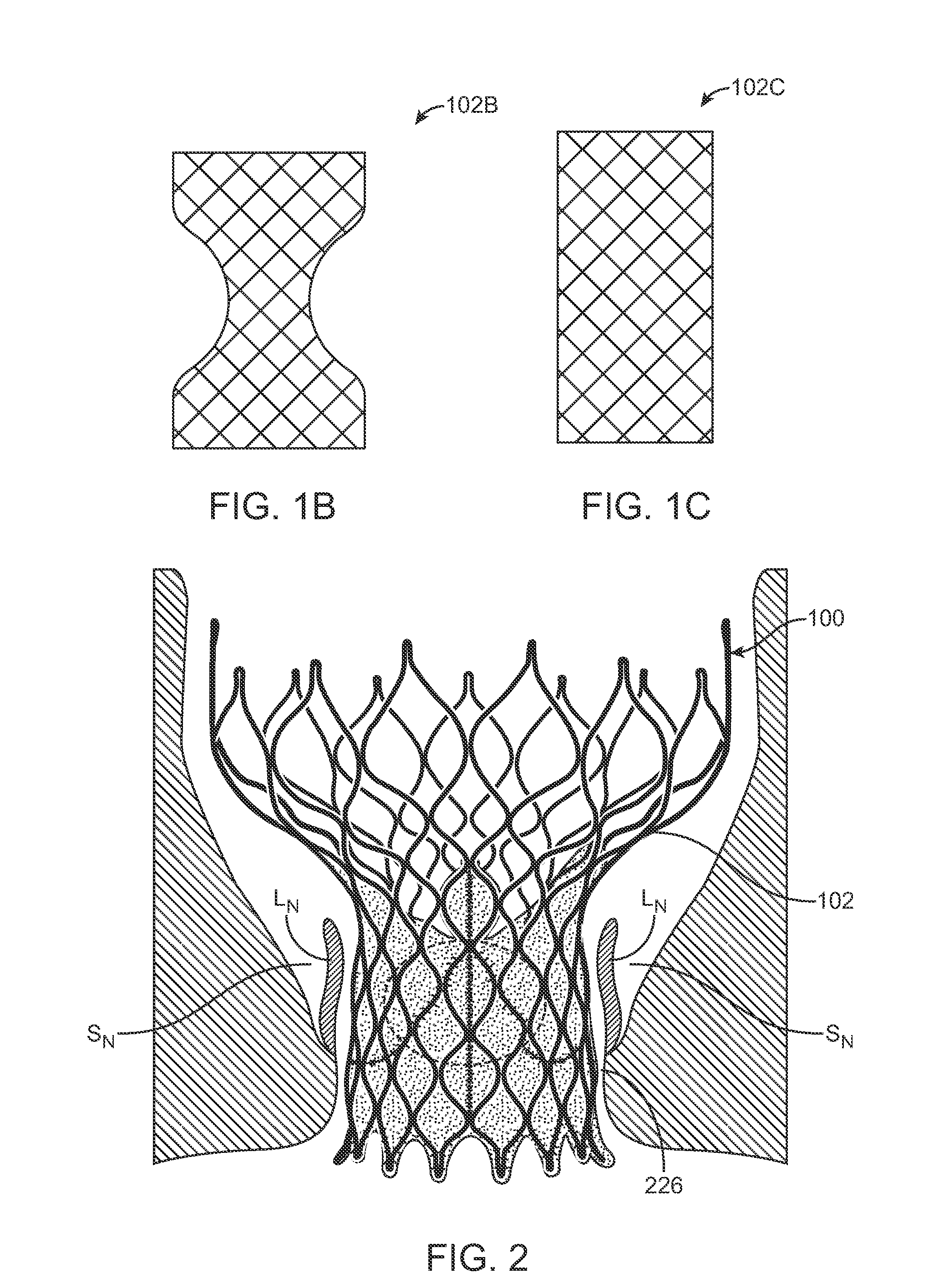 Anti-Paravalvular Leakage Component for a Transcatheter Valve Prosthesis