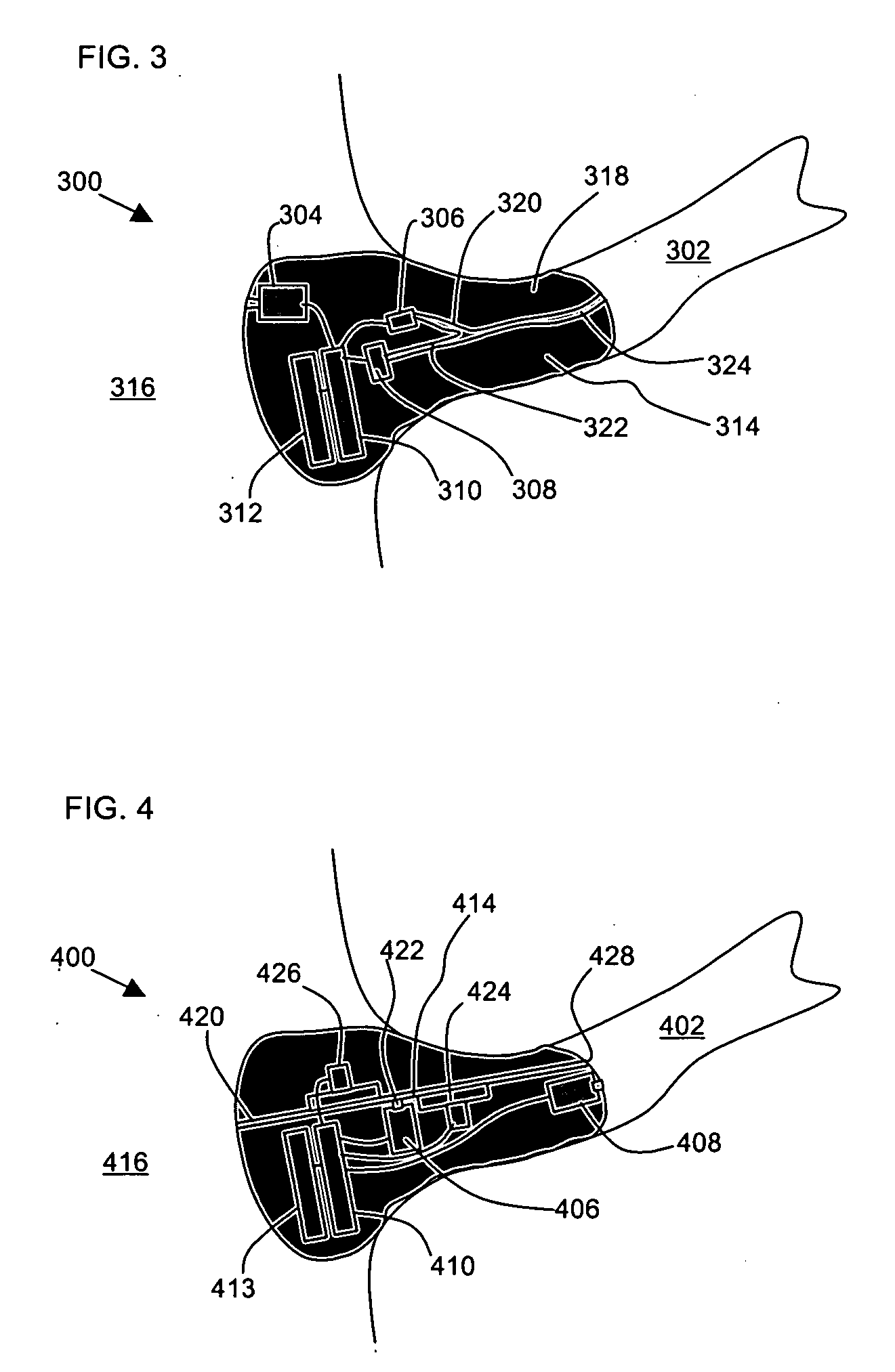 Device and method for remote acoustic porting and magnetic acoustic connection