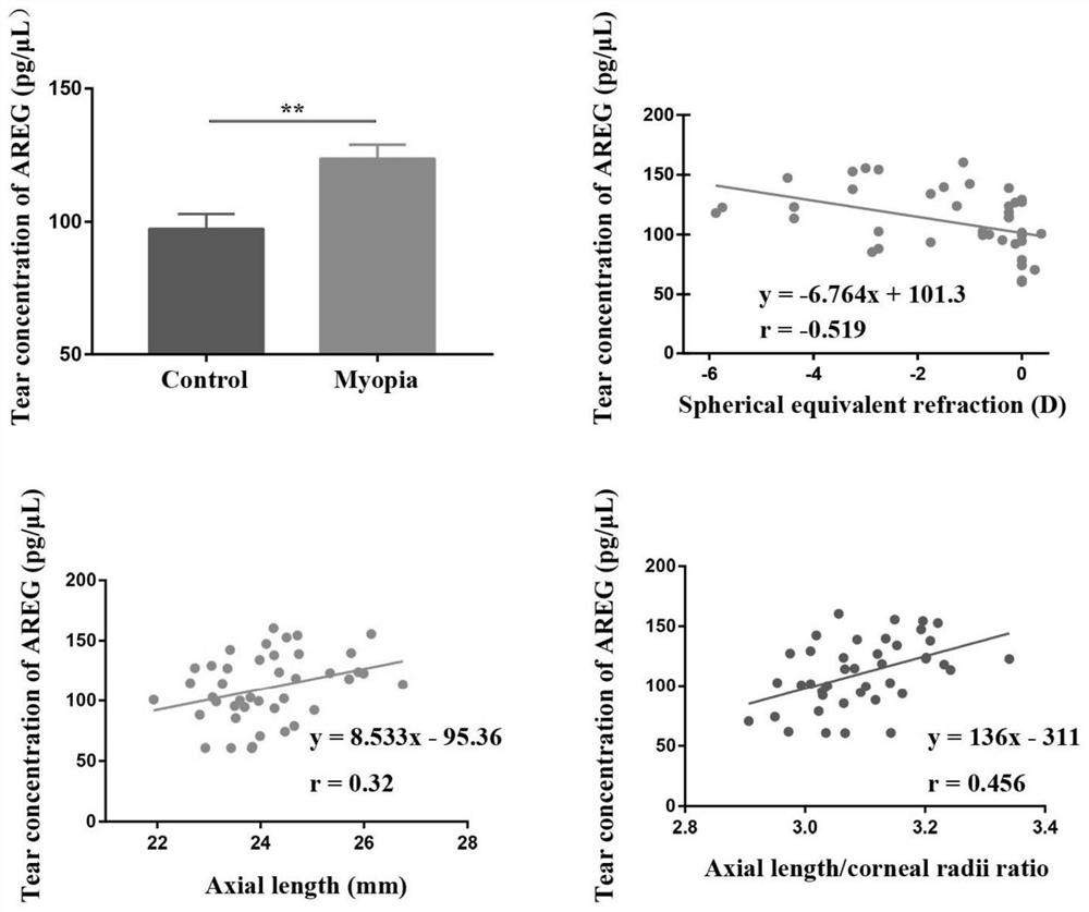 Kit for predicting, preventing and treating myopia