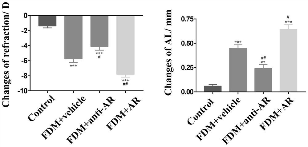 Kit for predicting, preventing and treating myopia