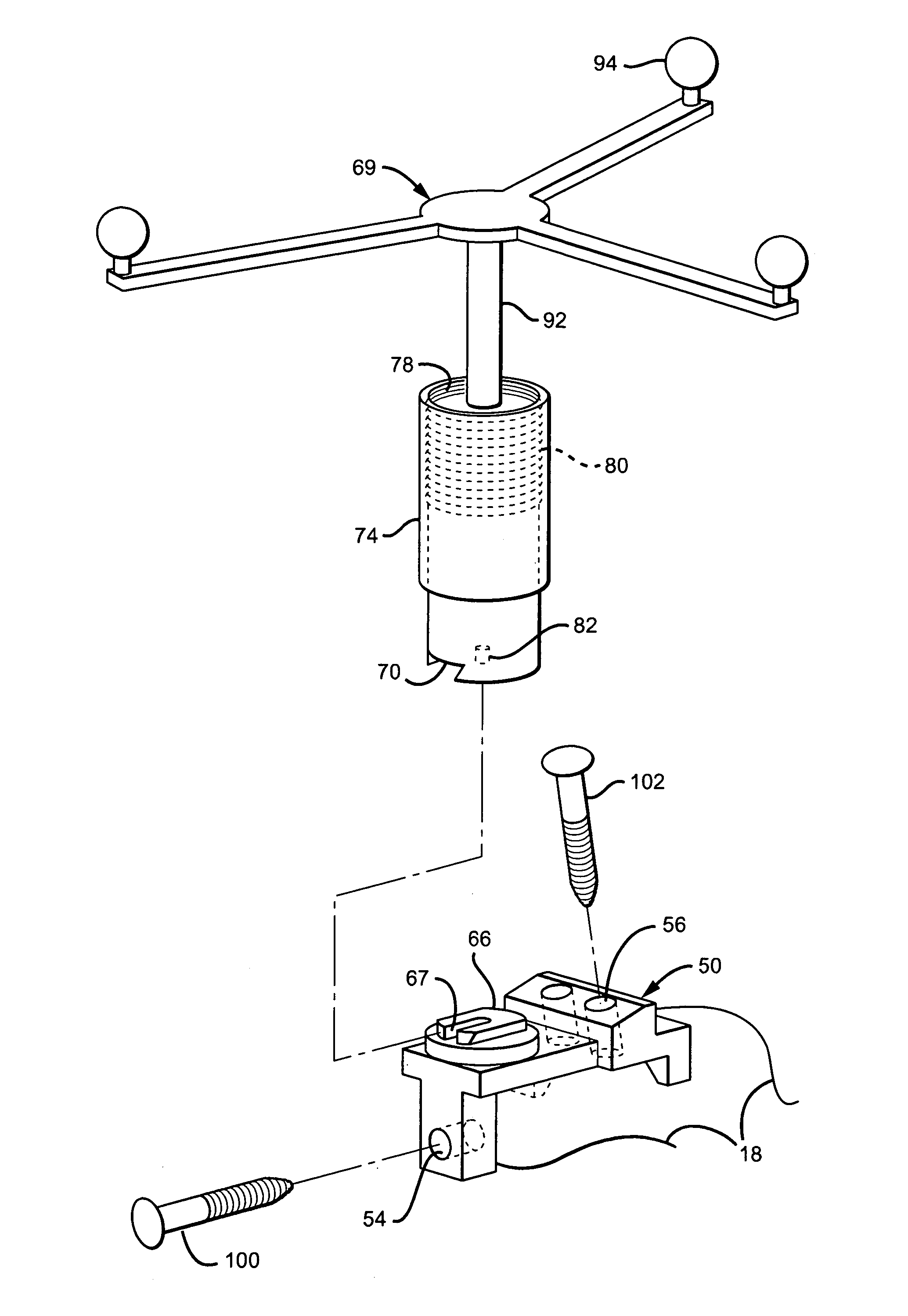 Tracking tools and method for computer-assisted shoulder replacement surgery