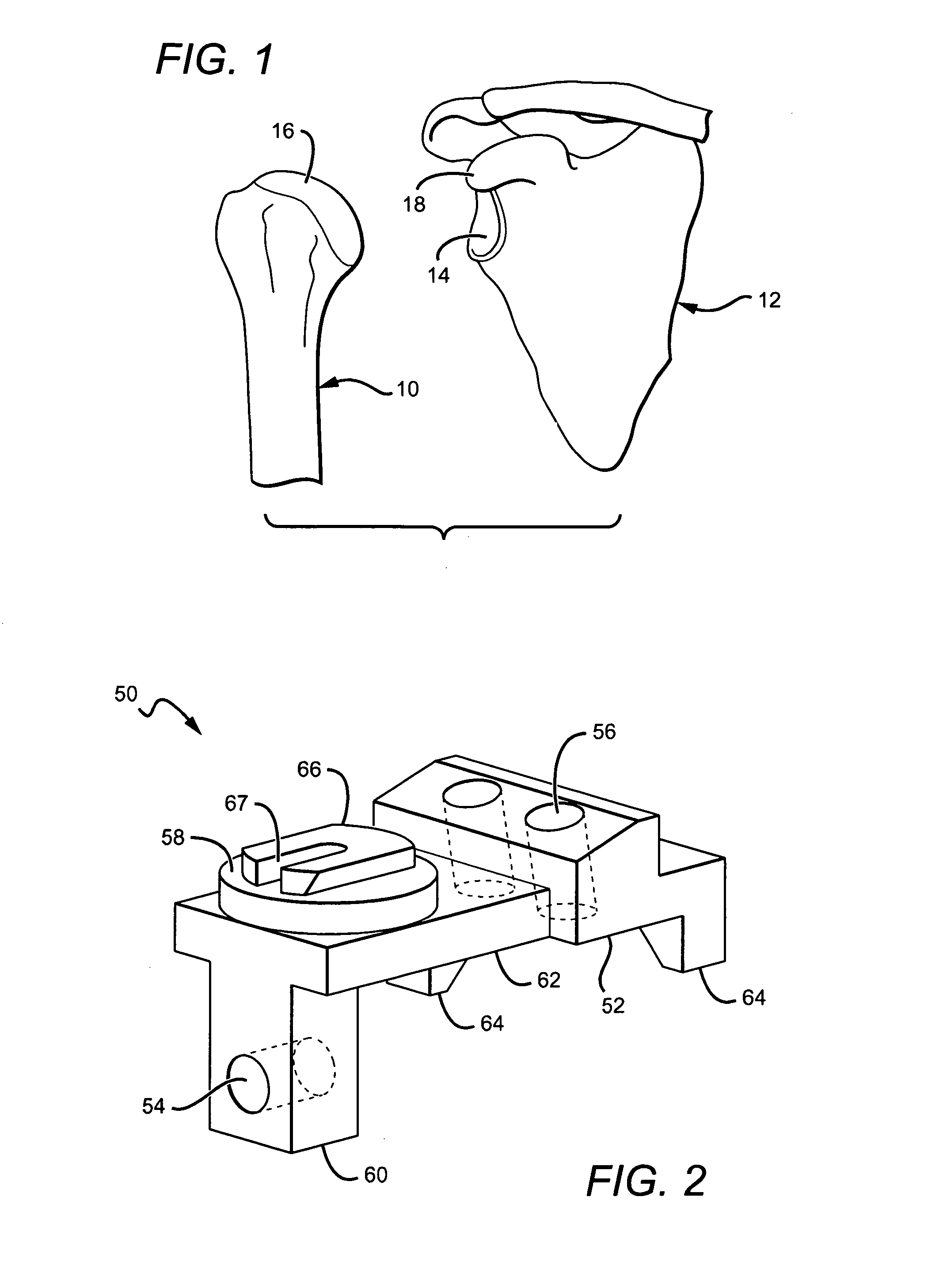 Tracking tools and method for computer-assisted shoulder replacement surgery