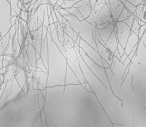 Streptomyces violaceorubidus and application thereof