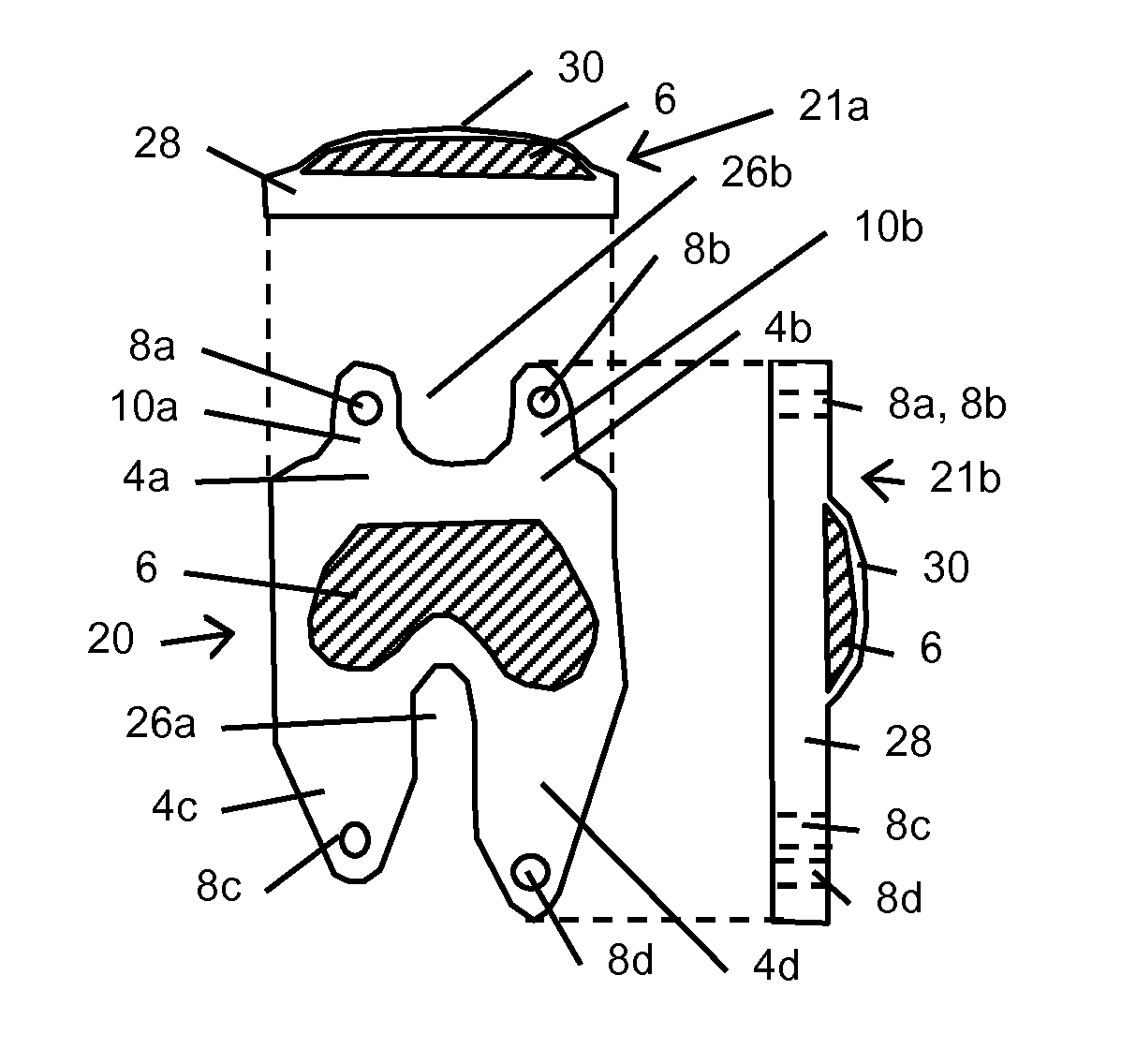 Resilient interpositional arthroplasty device