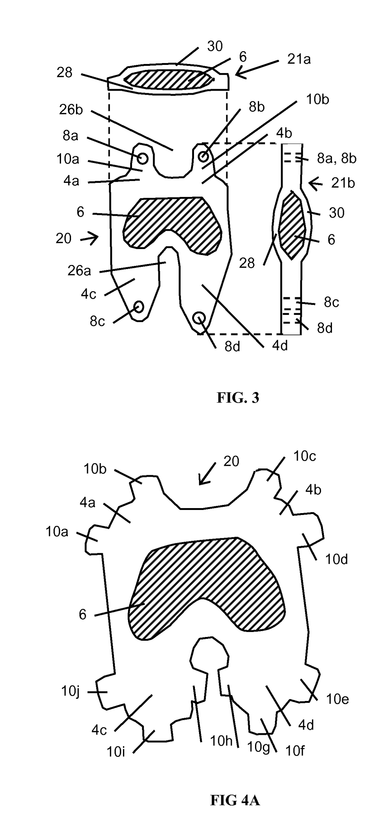 Resilient interpositional arthroplasty device