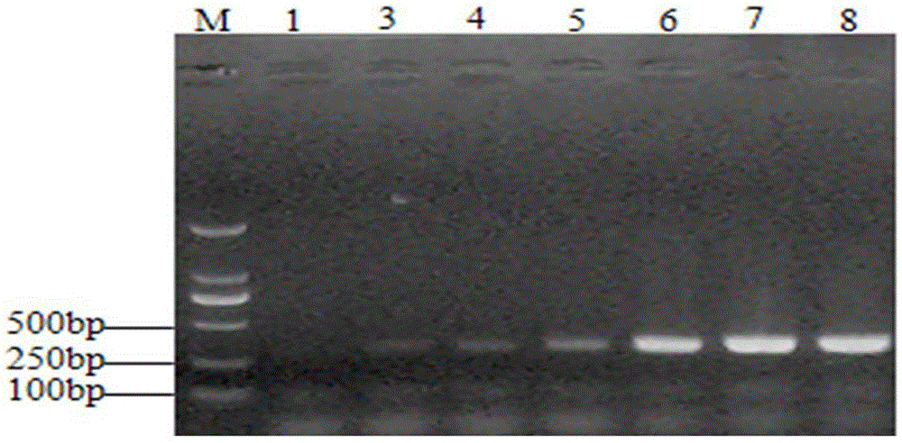 Enterobacter cloacae specific PCR (polymerase chain reaction) detection primer