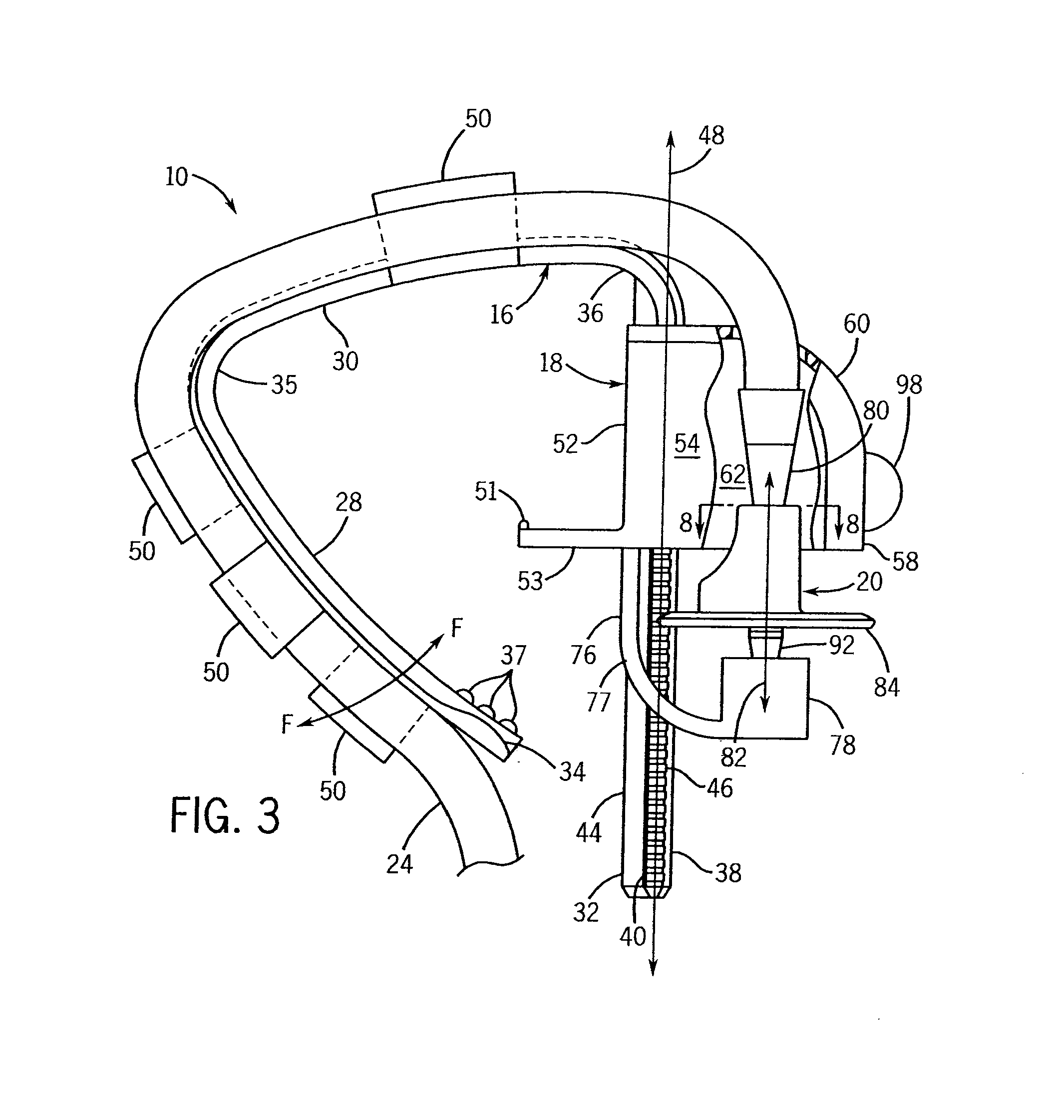 Clip for Mounting a Fluid Delivery Device