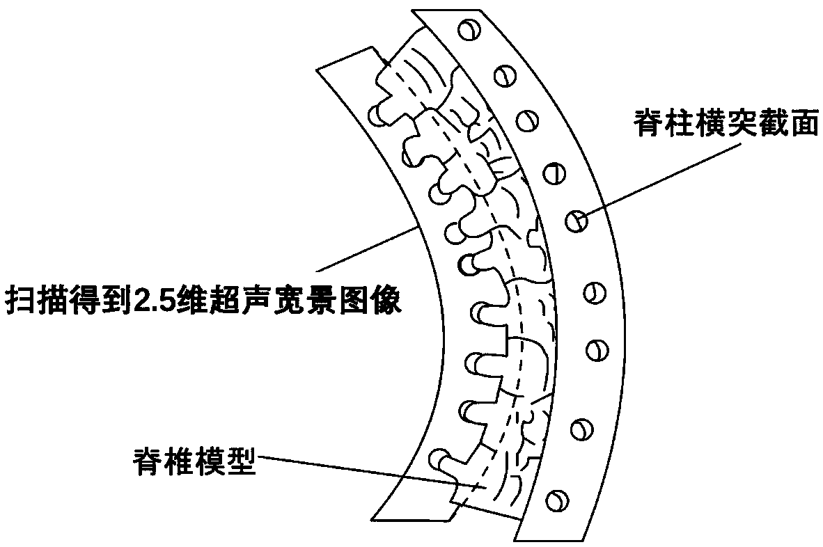 Method for reproducing spinal three-dimensional structure based on 2.5-dimensional ultrasonic panoramic imaging