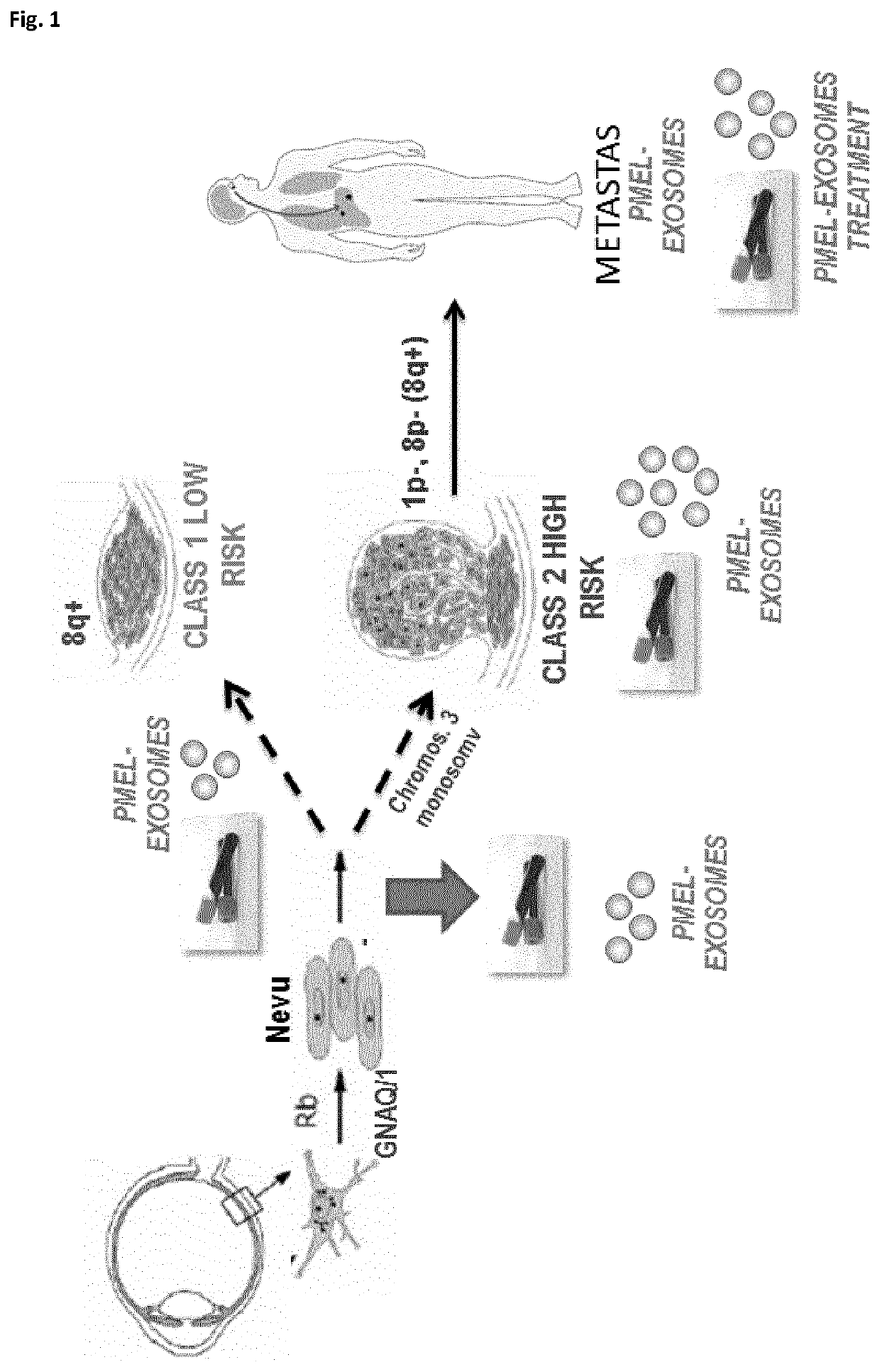 In vitro method for detecting tumor growth and diagnosing or prognosticating the risk of metastasis in a human subject that has been diagnosed with uveal melanoma