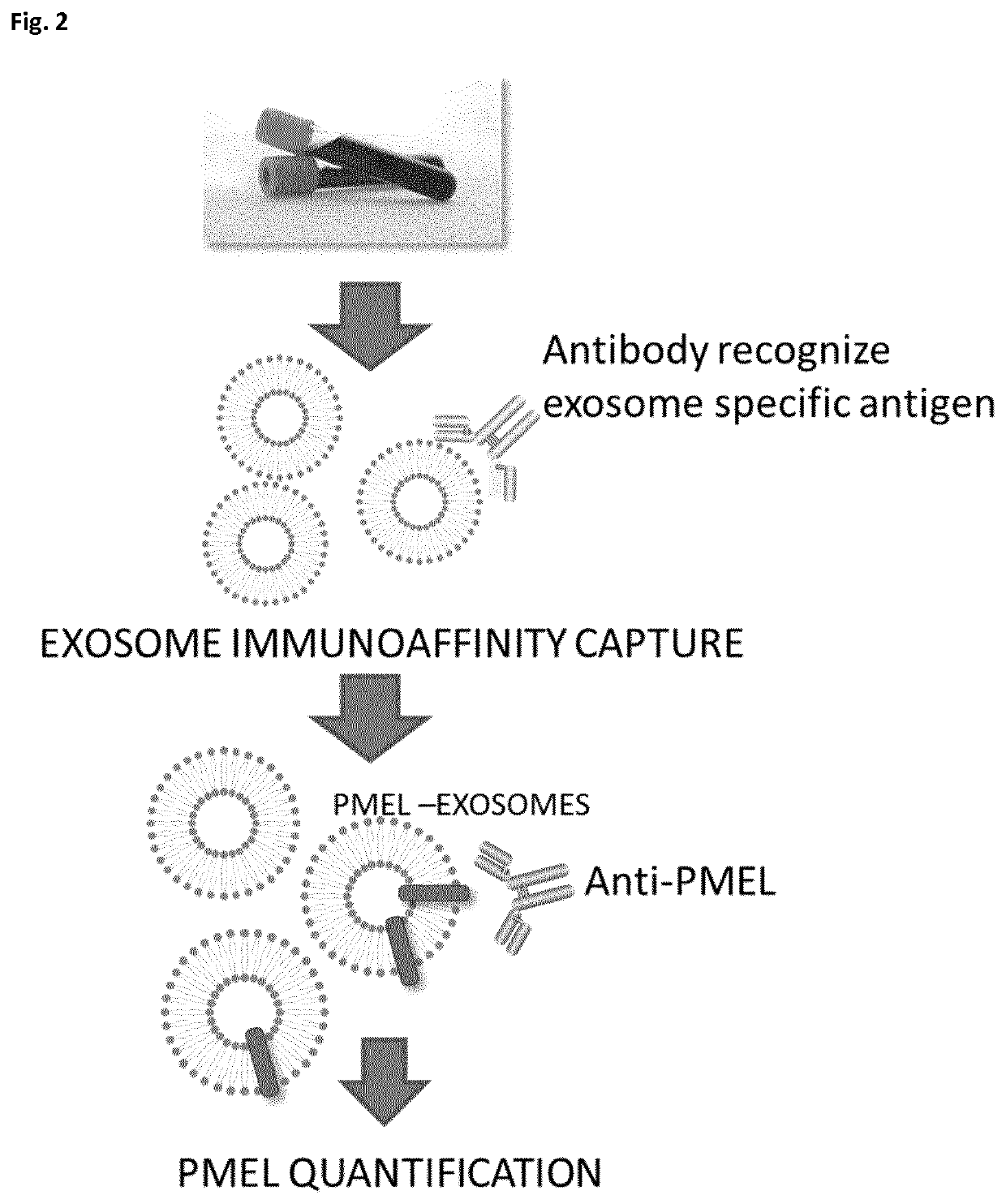 In vitro method for detecting tumor growth and diagnosing or prognosticating the risk of metastasis in a human subject that has been diagnosed with uveal melanoma